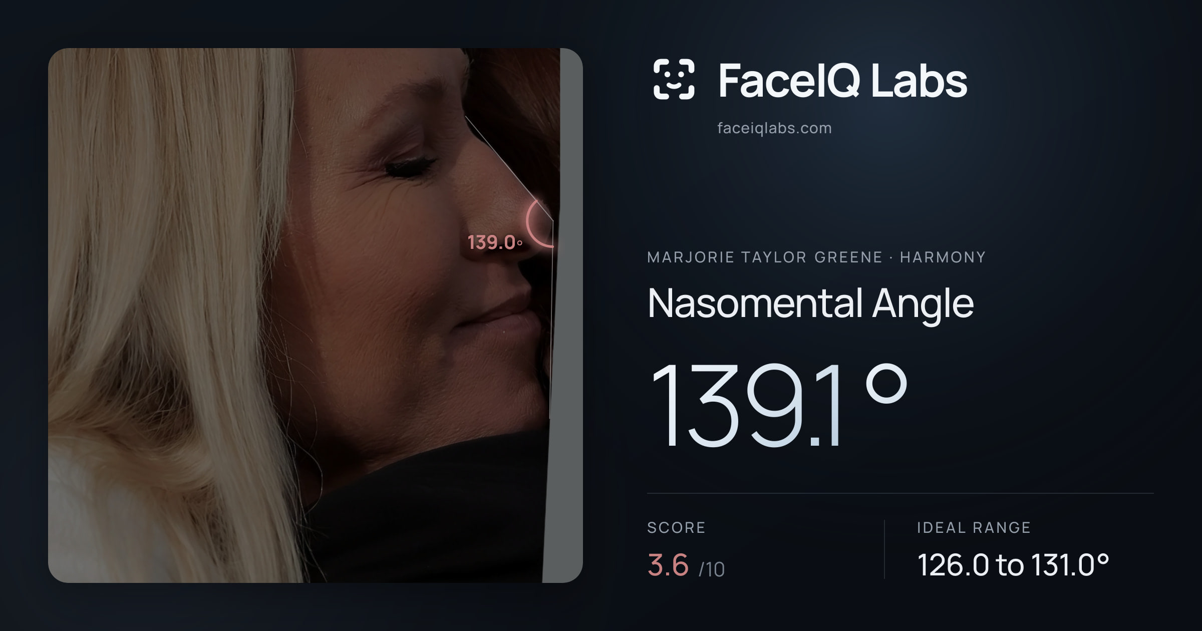 Marjorie Taylor Greene Nasomental Angle: 139.1°, drawn on the photo
