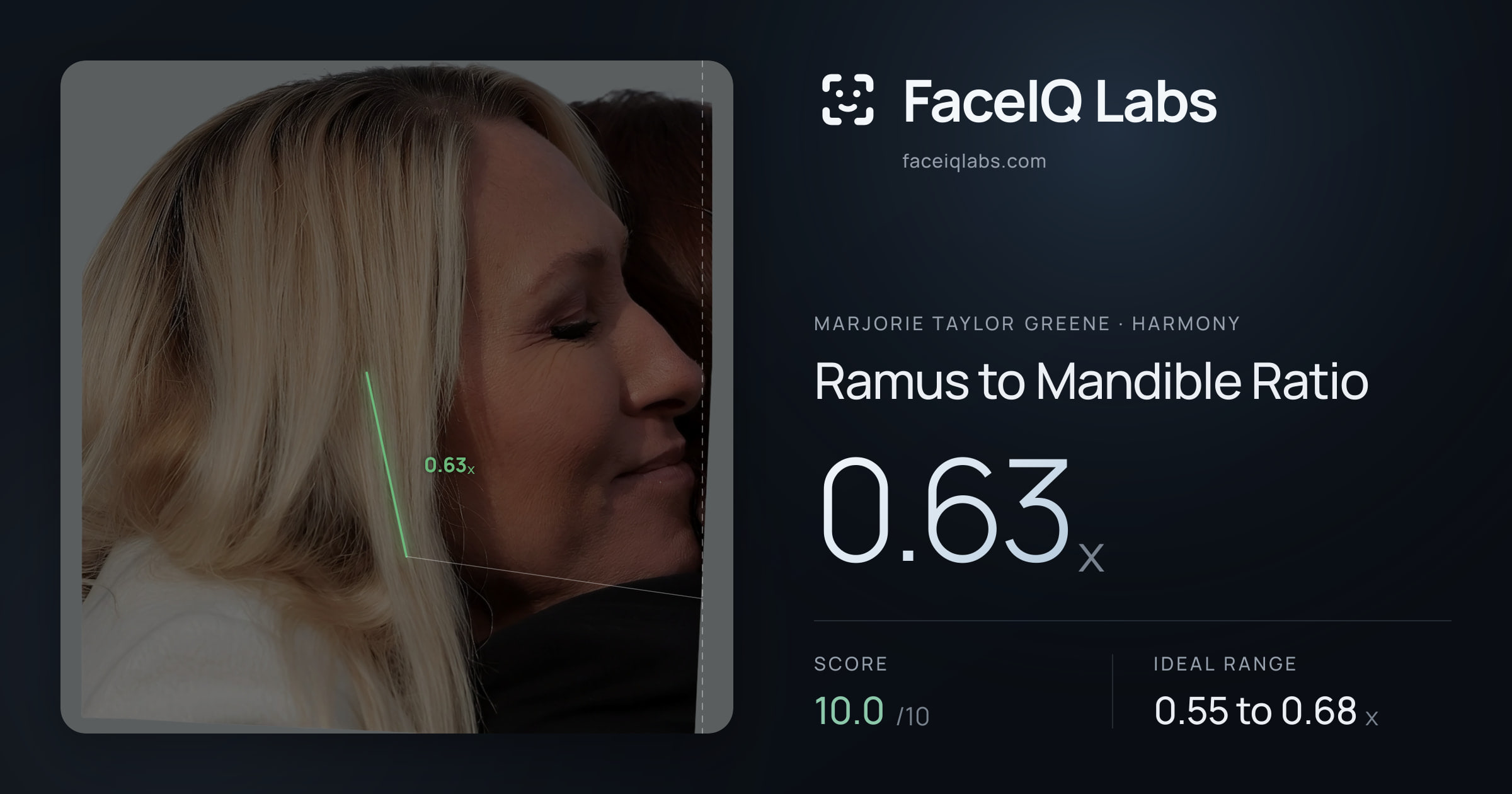Marjorie Taylor Greene Ramus to Mandible Ratio: 0.63x, drawn on the photo