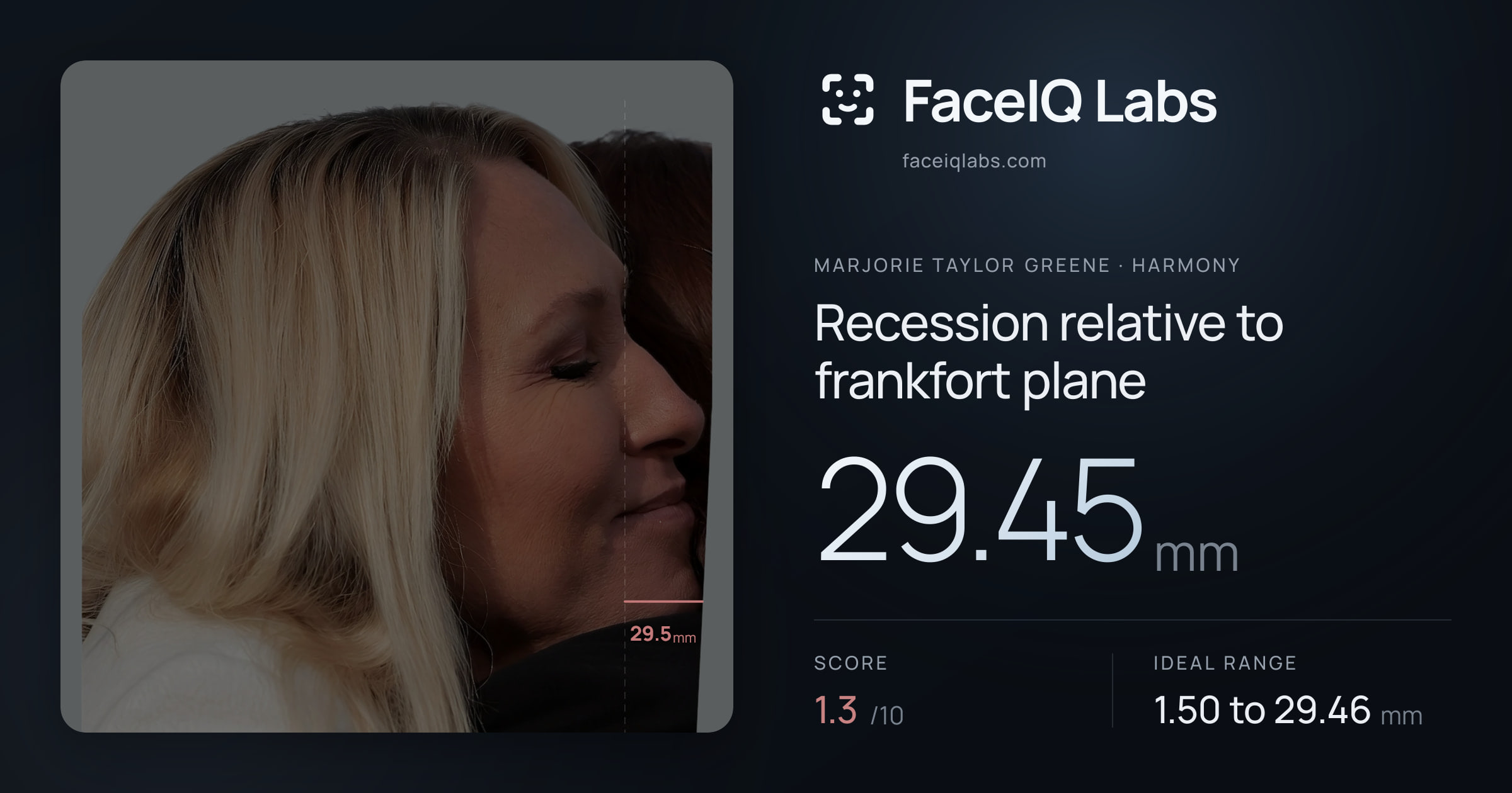 Marjorie Taylor Greene Recession relative to frankfort plane: 29.45mm, drawn on the photo