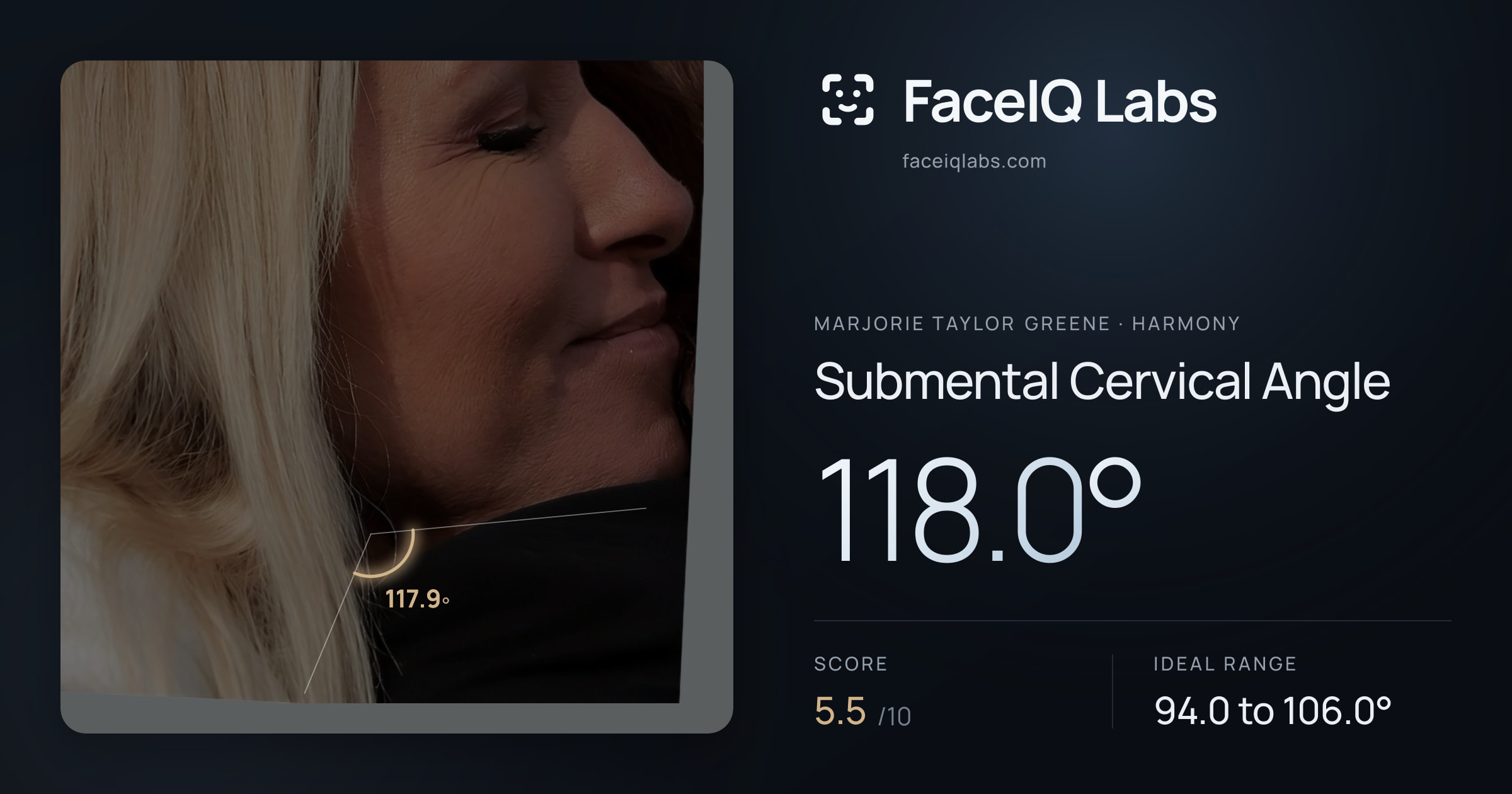 Marjorie Taylor Greene Submental Cervical Angle: 118.0°, drawn on the photo