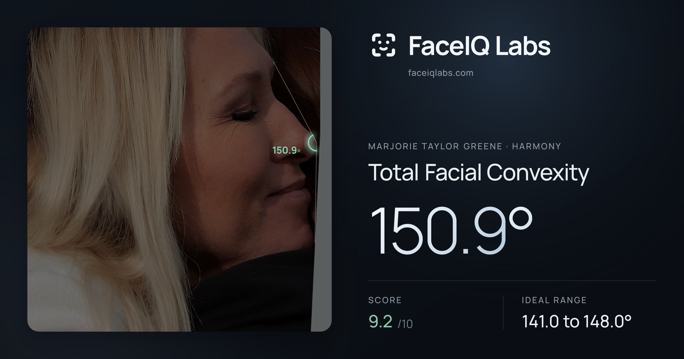 Marjorie Taylor Greene Total Facial Convexity: 150.9°, drawn on the photo