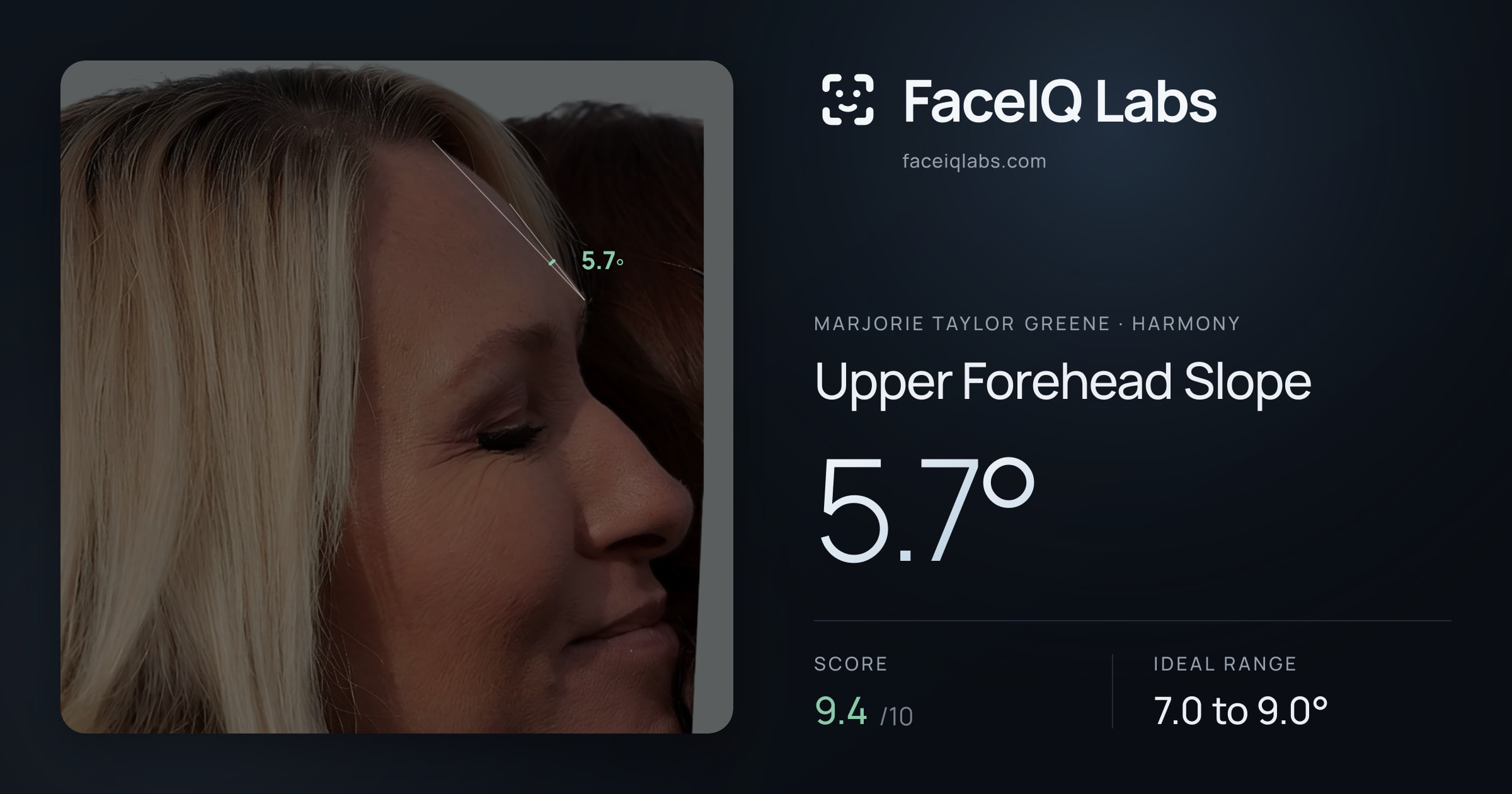 Marjorie Taylor Greene Upper Forehead Slope: 5.7°, drawn on the photo