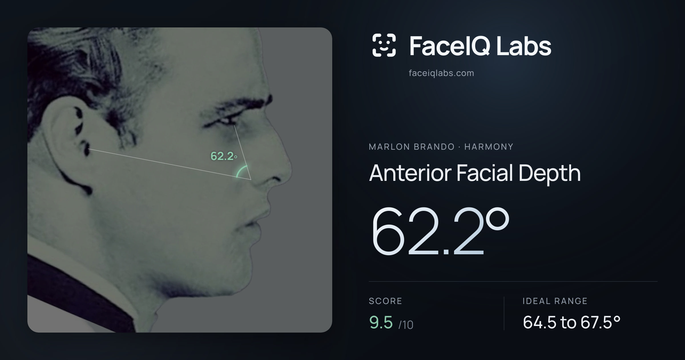 Marlon Brando Anterior Facial Depth: 62.2°, drawn on the photo