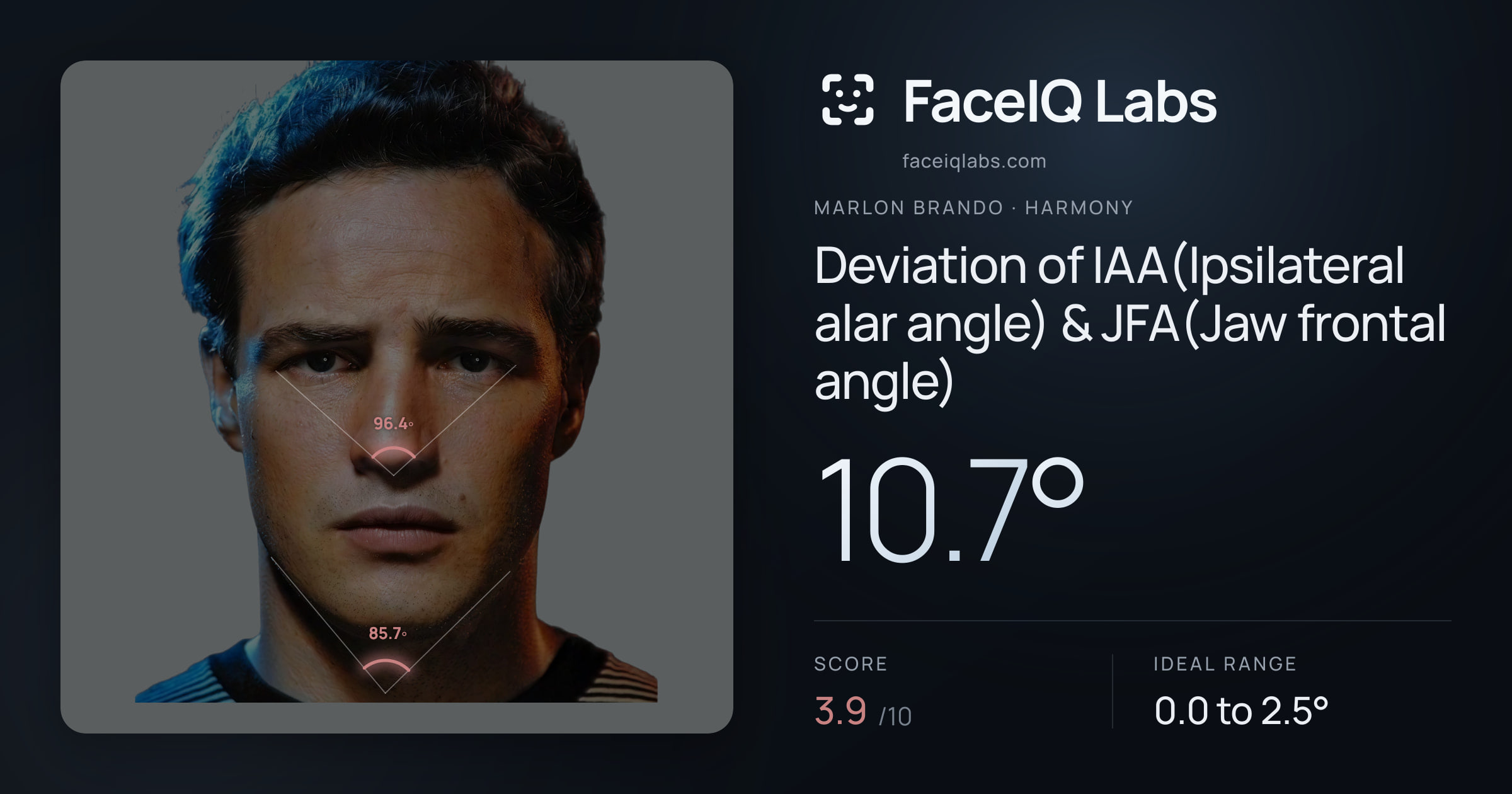 Marlon Brando Deviation of IAA(Ipsilateral alar angle) & JFA(Jaw frontal angle): 10.7°, drawn on the photo