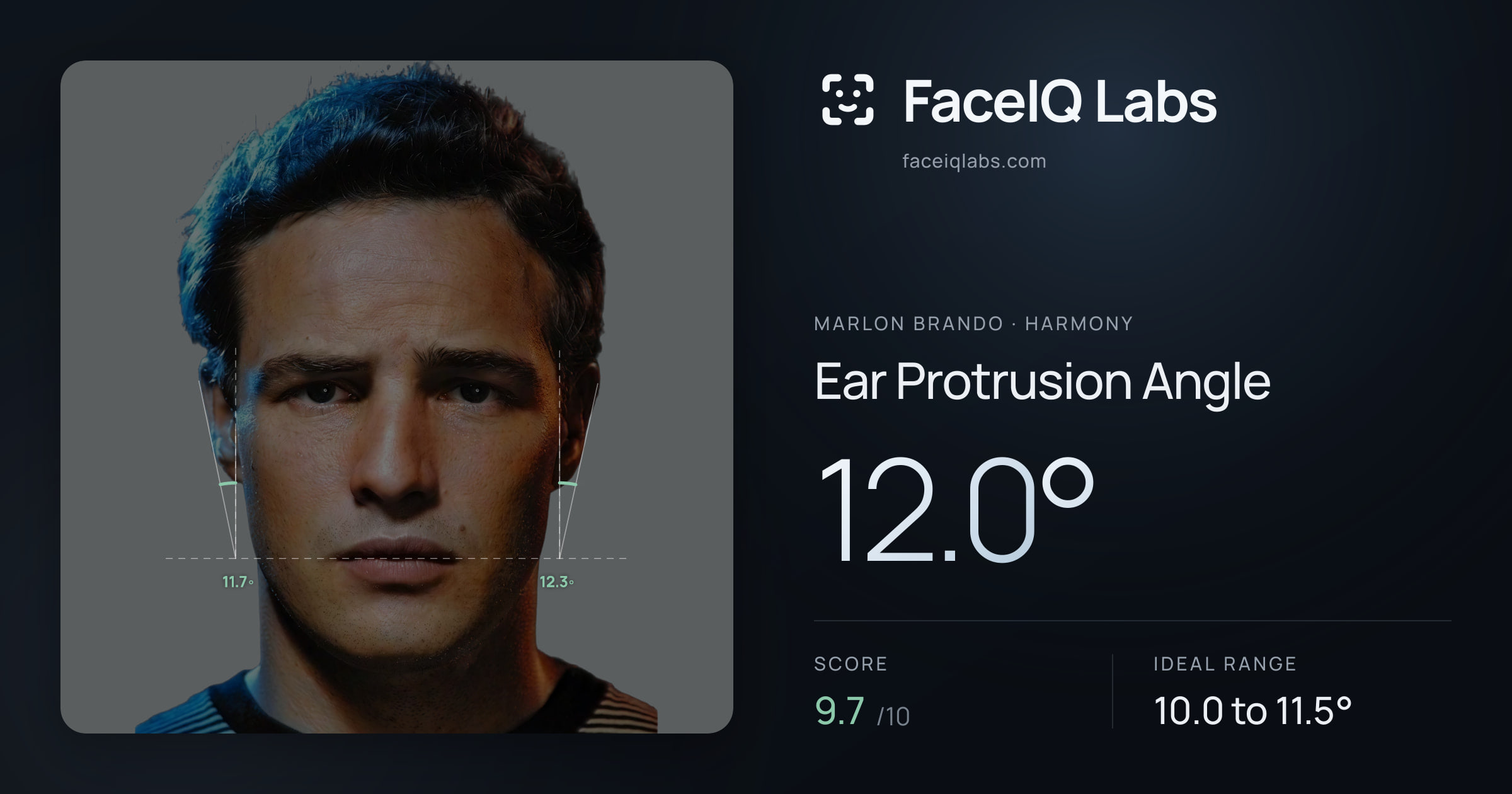 Marlon Brando Ear Protrusion Angle: 12.0°, drawn on the photo