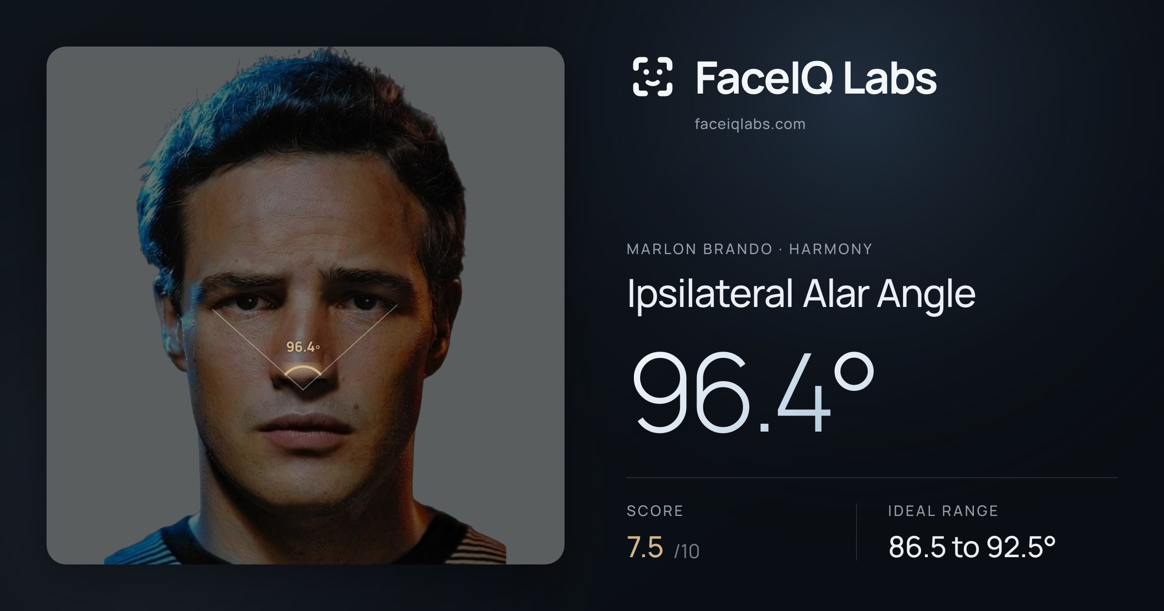 Marlon Brando Ipsilateral Alar Angle: 96.4°, drawn on the photo