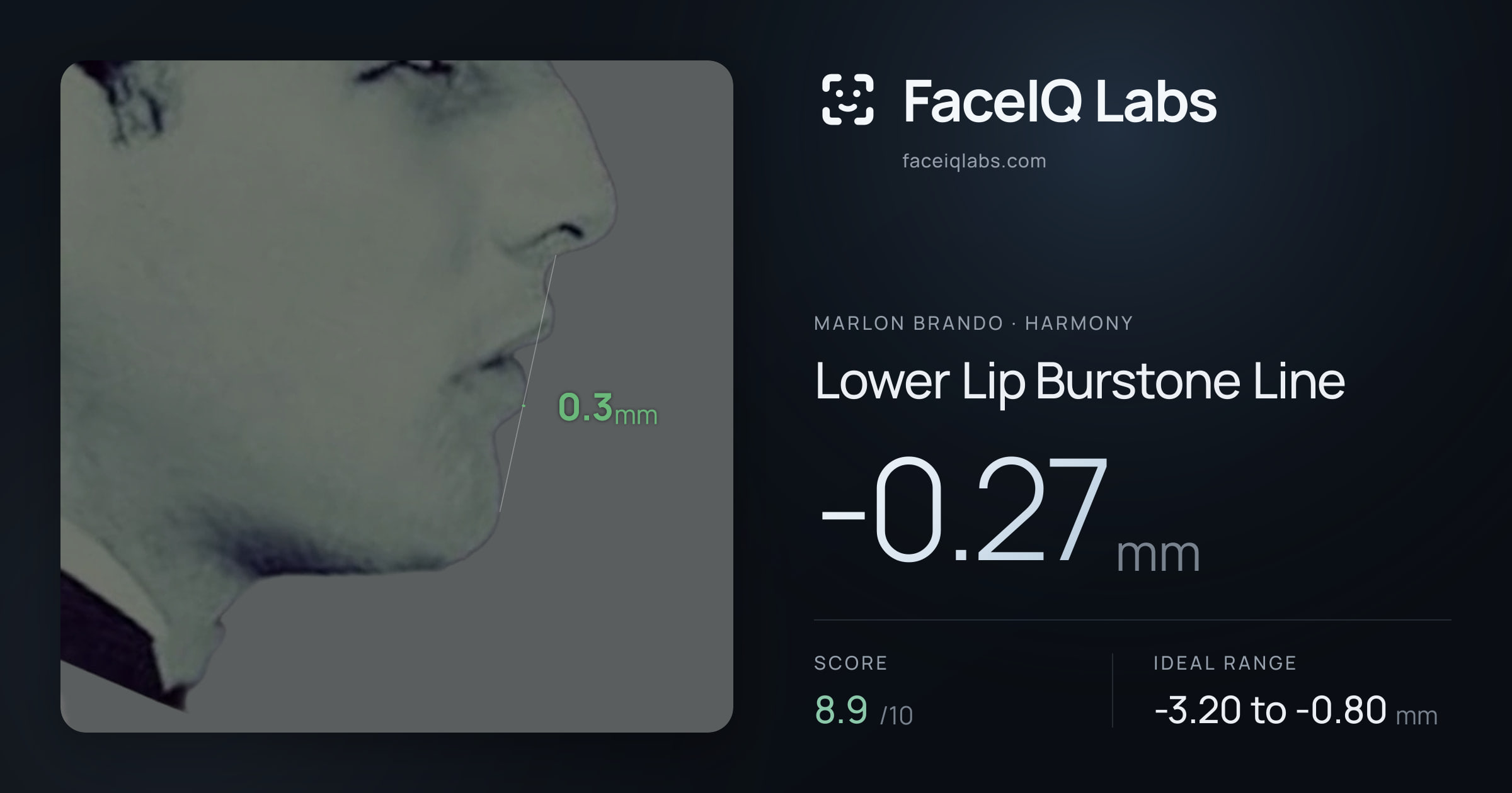 Marlon Brando Lower Lip Burstone Line: -0.27mm, drawn on the photo