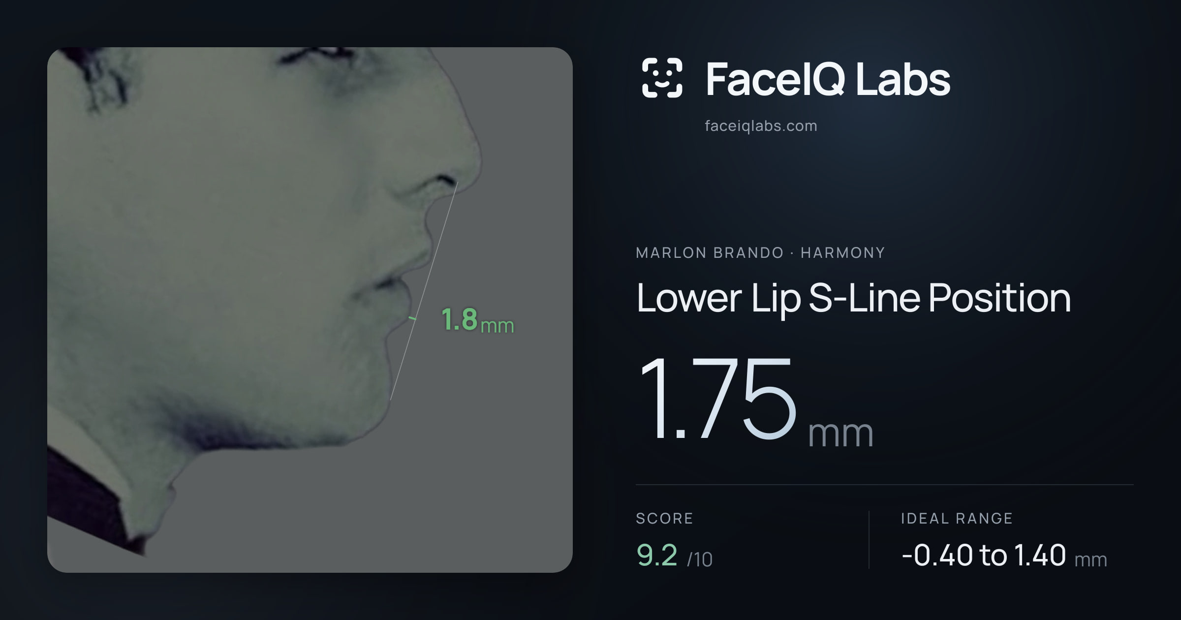 Marlon Brando Lower Lip S-Line Position: 1.75mm, drawn on the photo