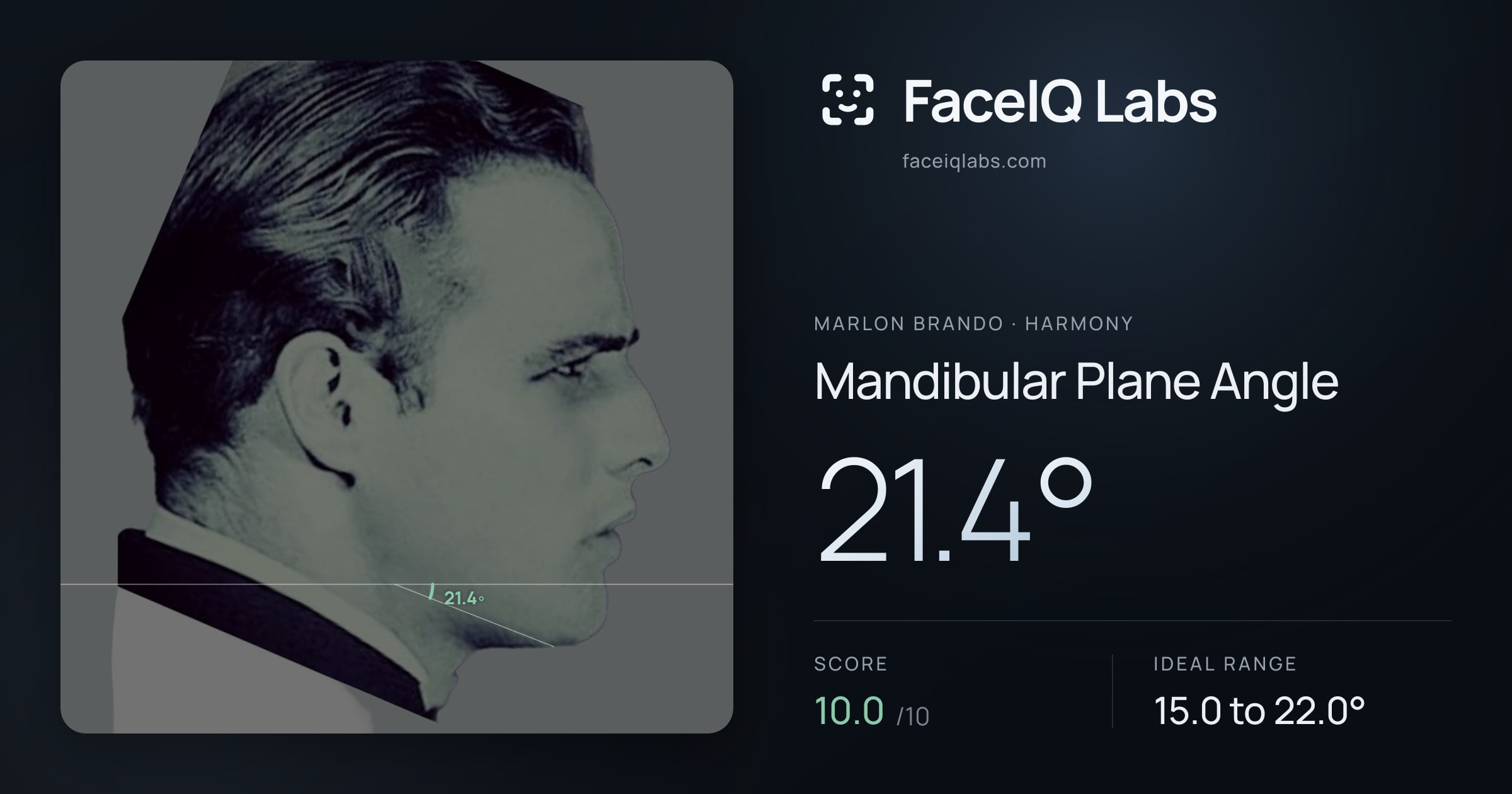 Marlon Brando Mandibular Plane Angle: 21.4°, drawn on the photo
