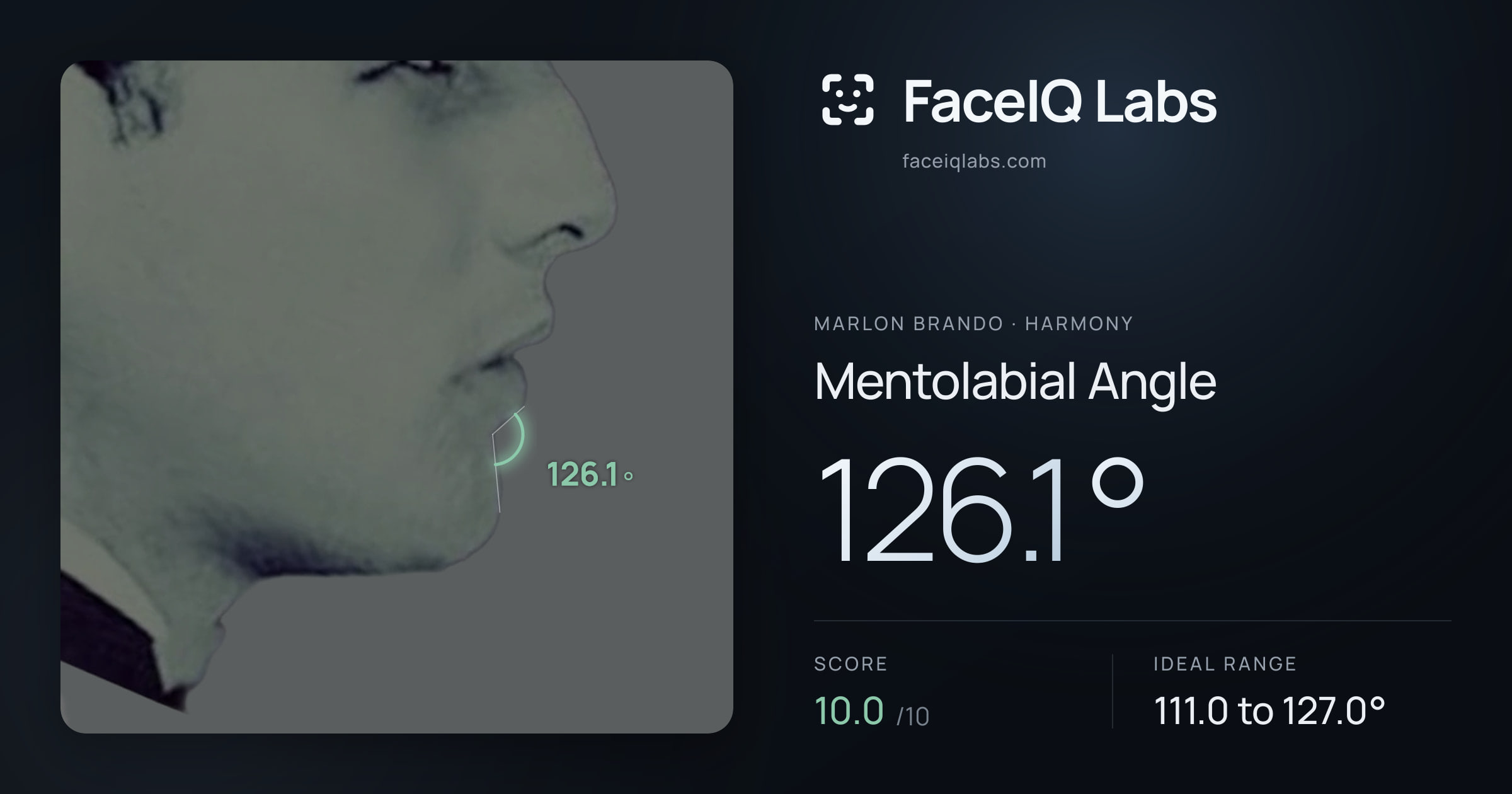 Marlon Brando Mentolabial Angle: 126.1°, drawn on the photo