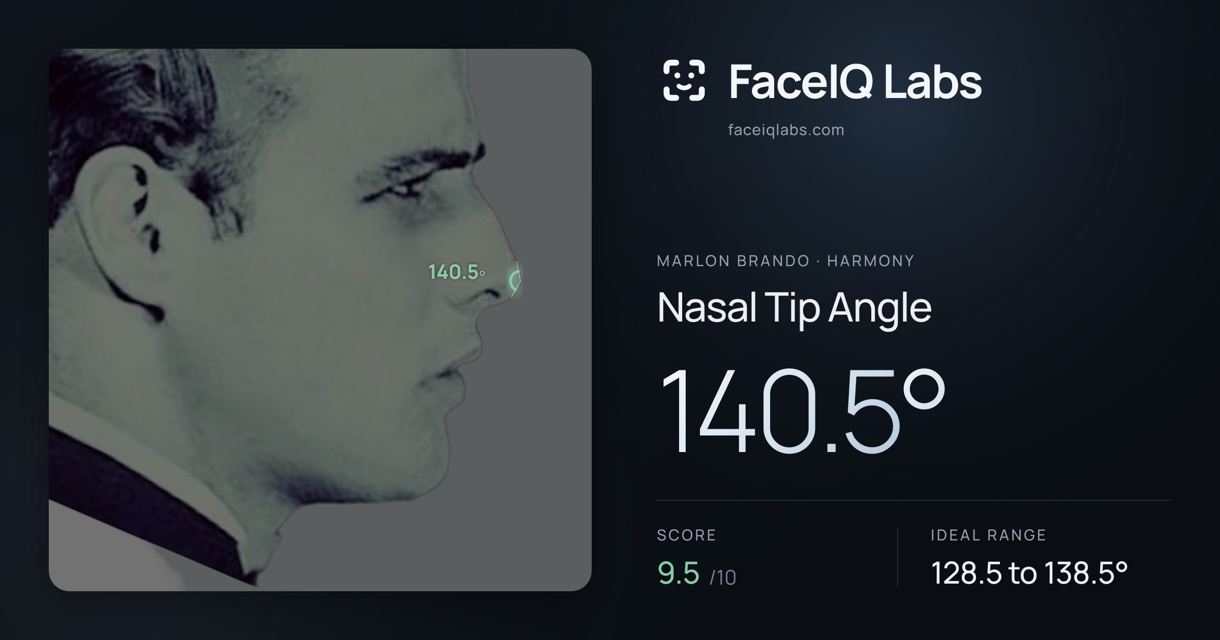 Marlon Brando Nasal Tip Angle: 140.5°, drawn on the photo