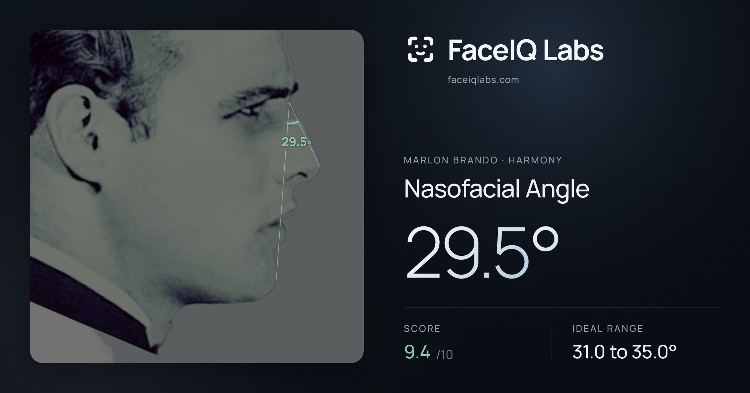Marlon Brando Nasofacial Angle: 29.5°, drawn on the photo
