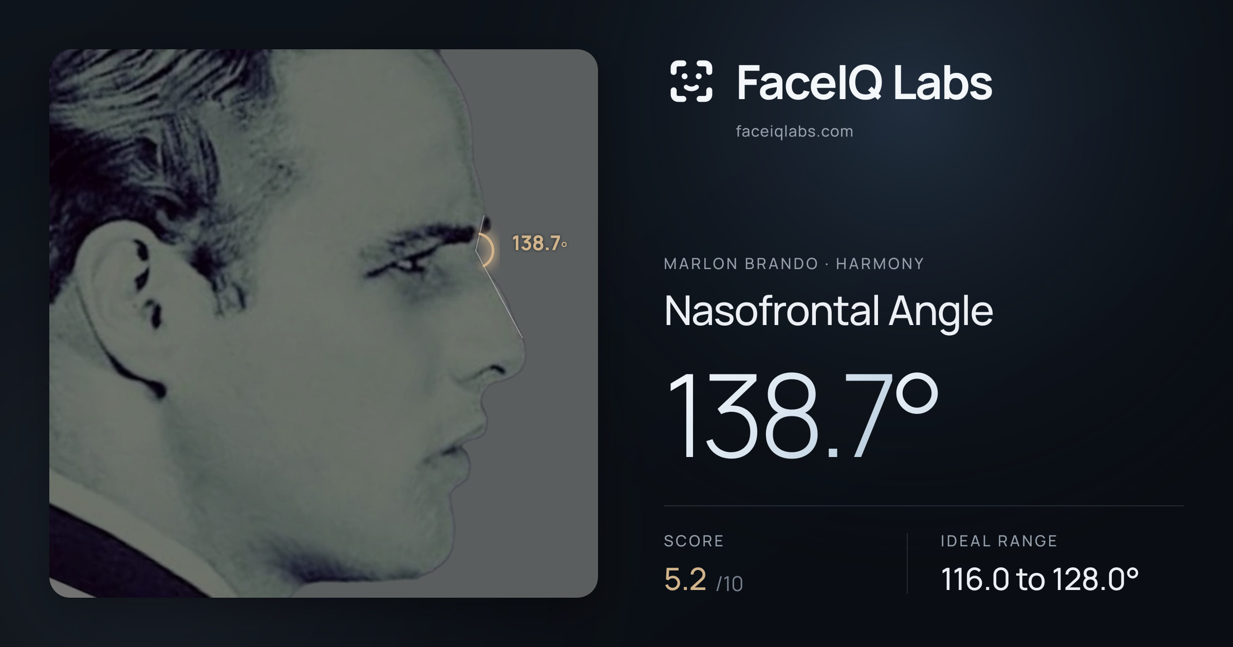 Marlon Brando Nasofrontal Angle: 138.7°, drawn on the photo