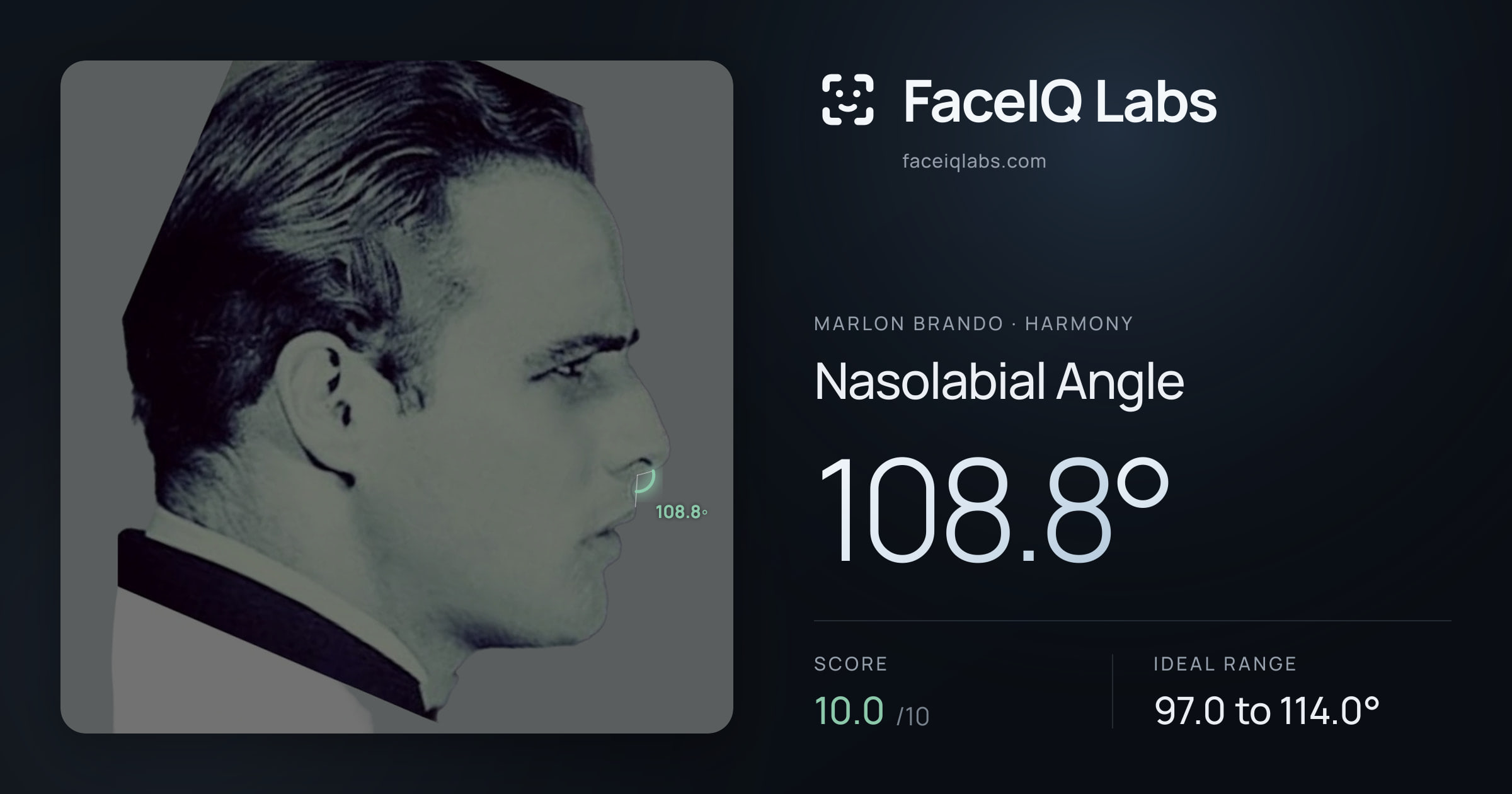 Marlon Brando Nasolabial Angle: 108.8°, drawn on the photo
