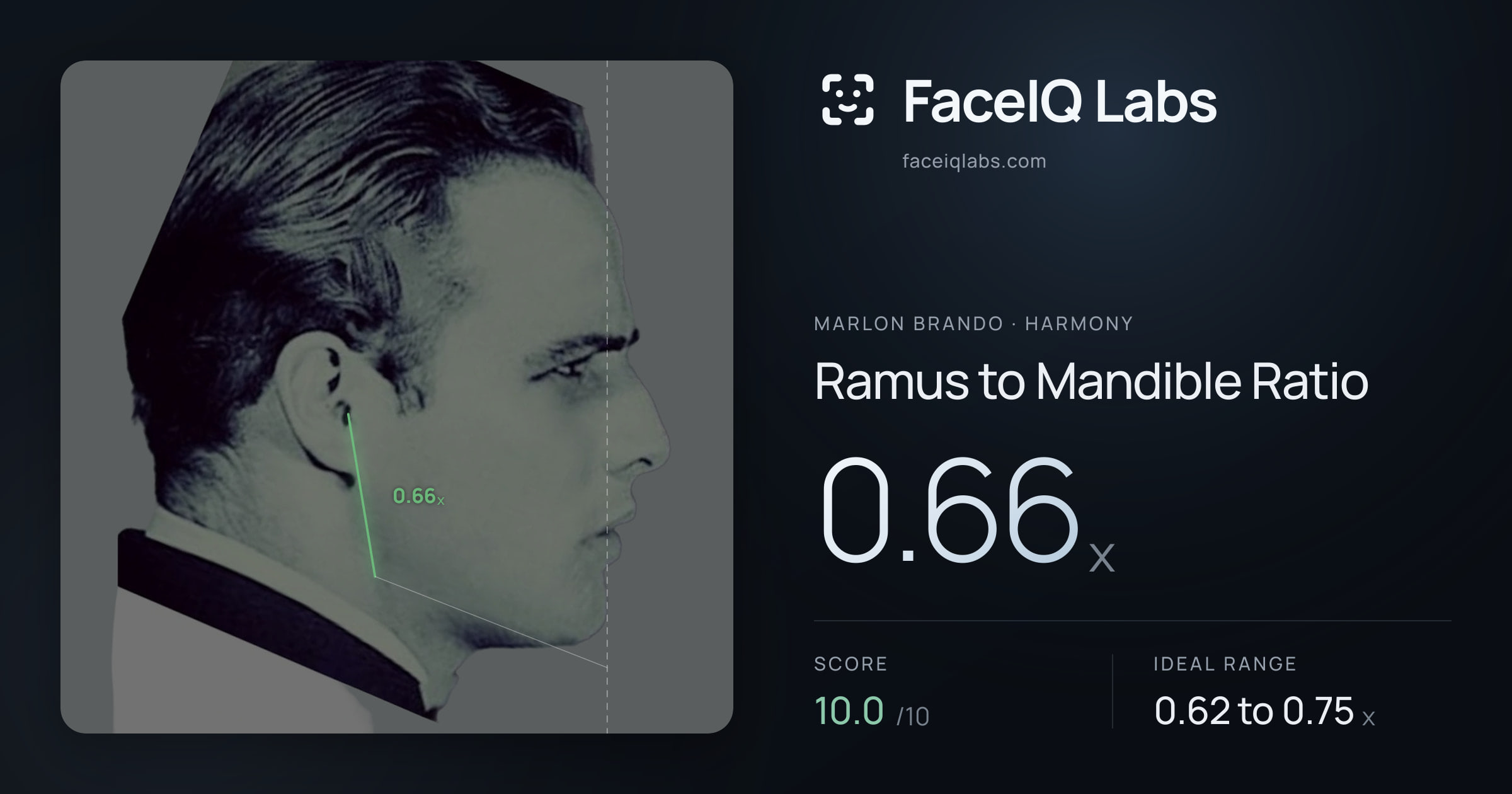 Marlon Brando Ramus to Mandible Ratio: 0.66x, drawn on the photo
