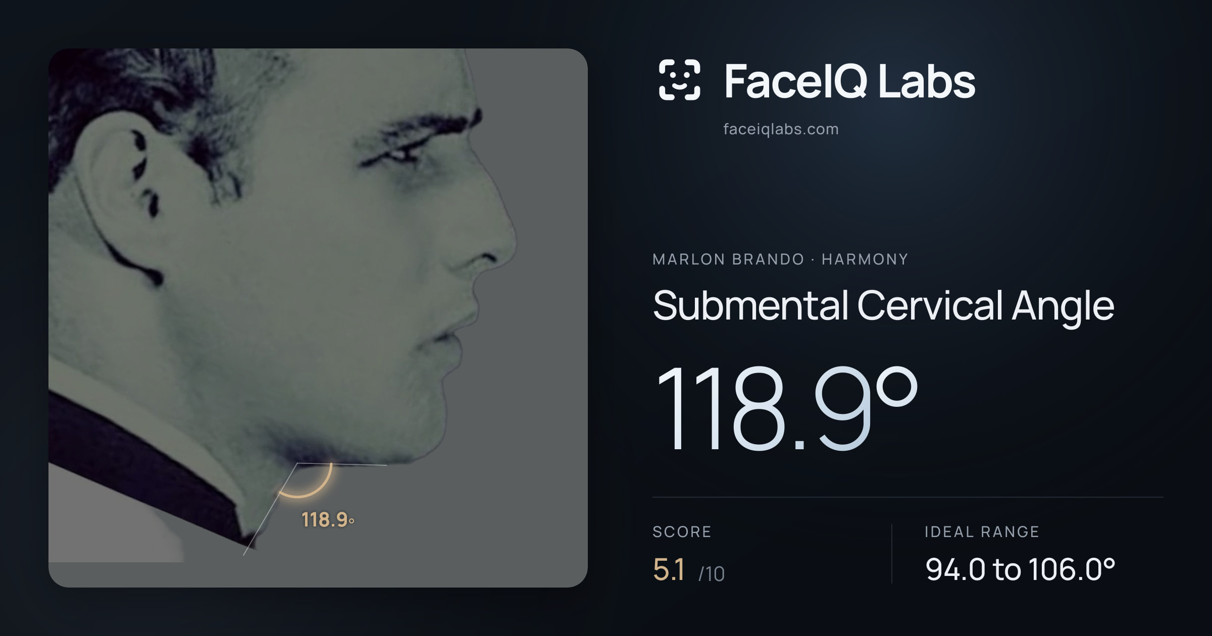 Marlon Brando Submental Cervical Angle: 118.9°, drawn on the photo