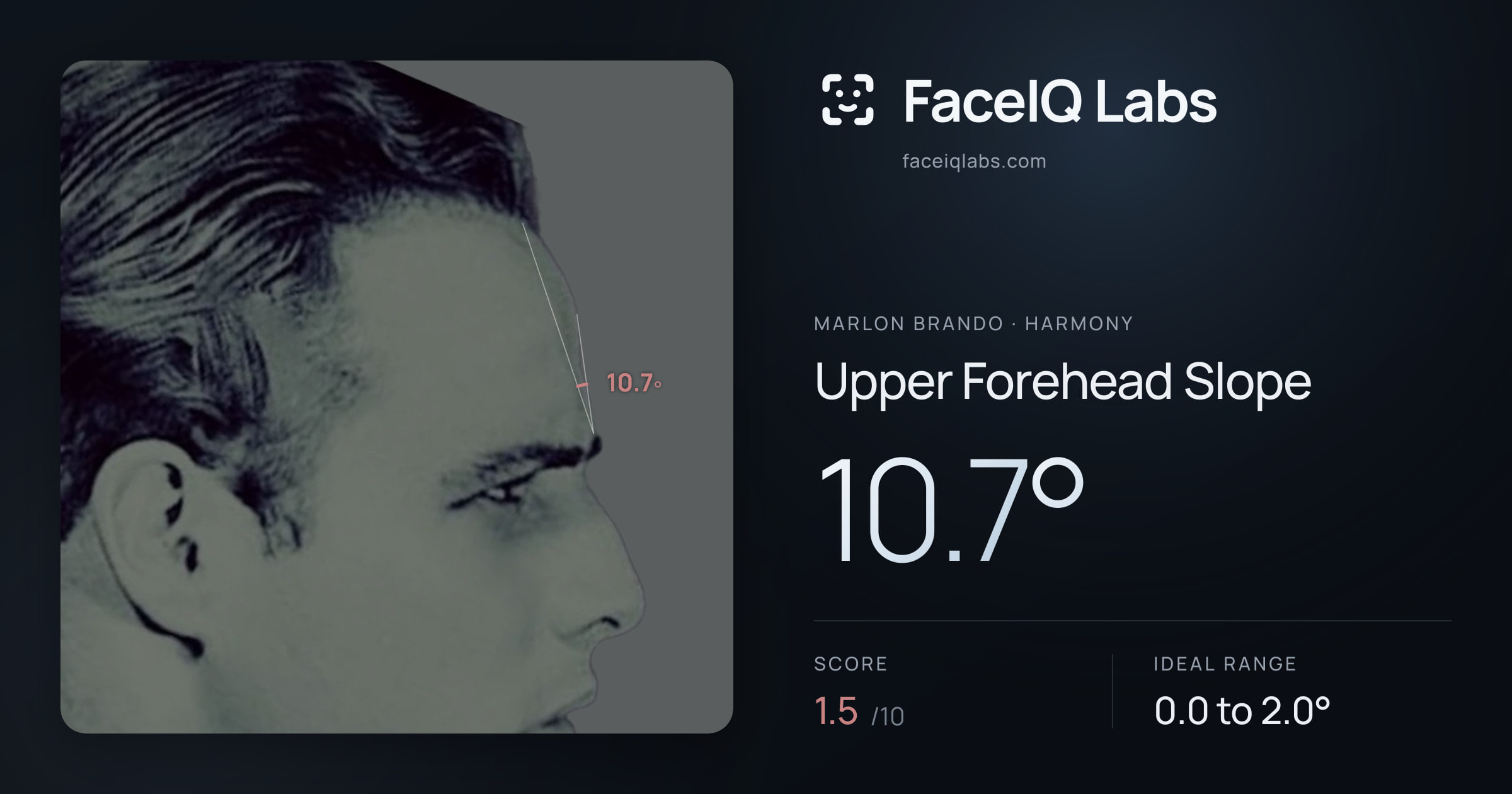 Marlon Brando Upper Forehead Slope: 10.7°, drawn on the photo