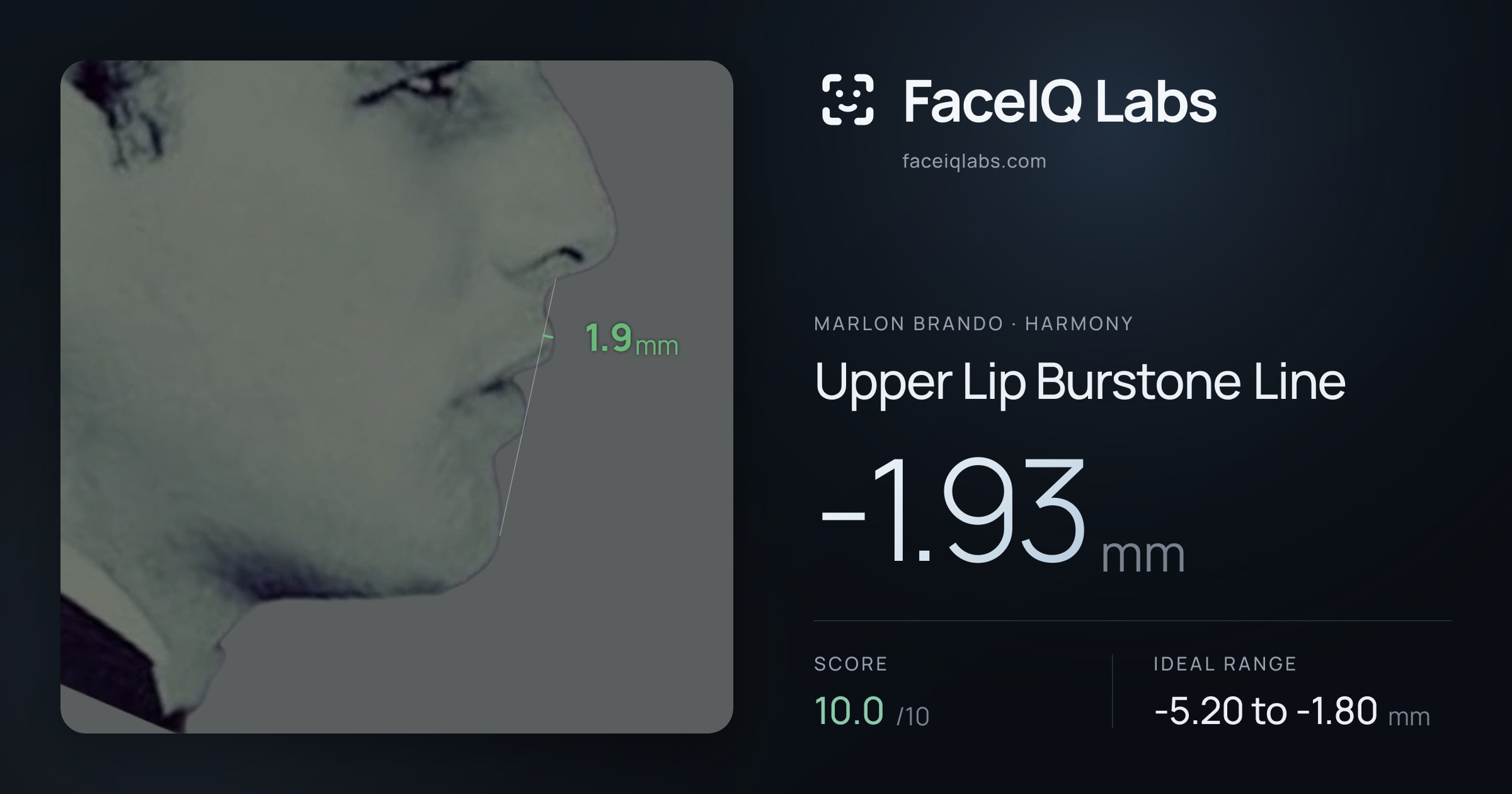 Marlon Brando Upper Lip Burstone Line: -1.93mm, drawn on the photo