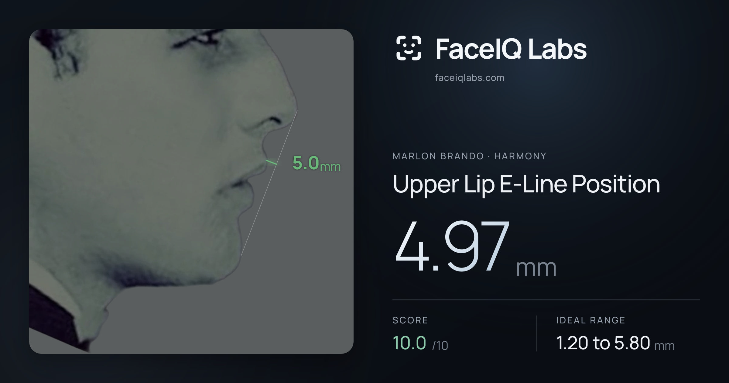 Marlon Brando Upper Lip E-Line Position: 4.97mm, drawn on the photo