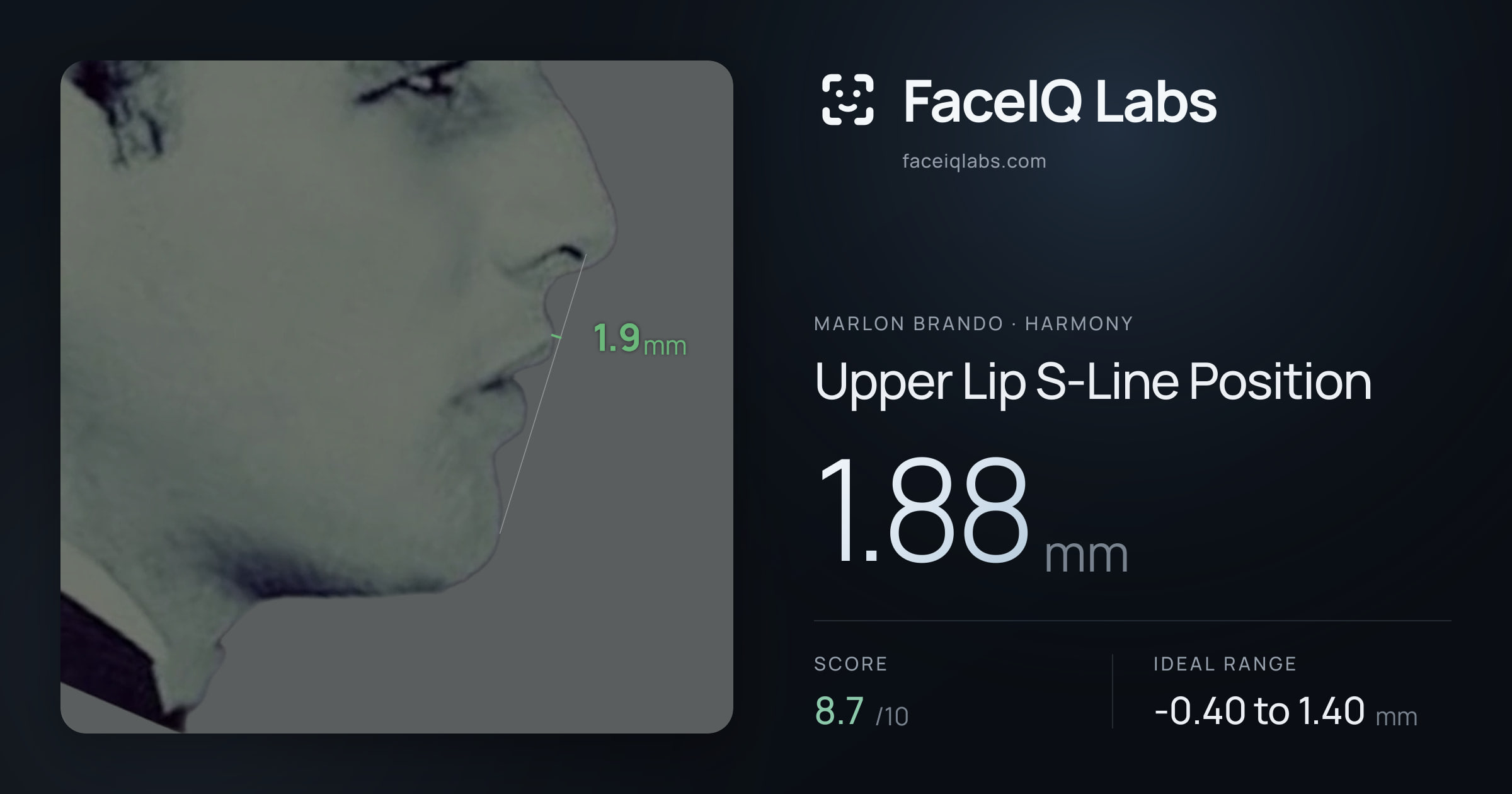 Marlon Brando Upper Lip S-Line Position: 1.88mm, drawn on the photo