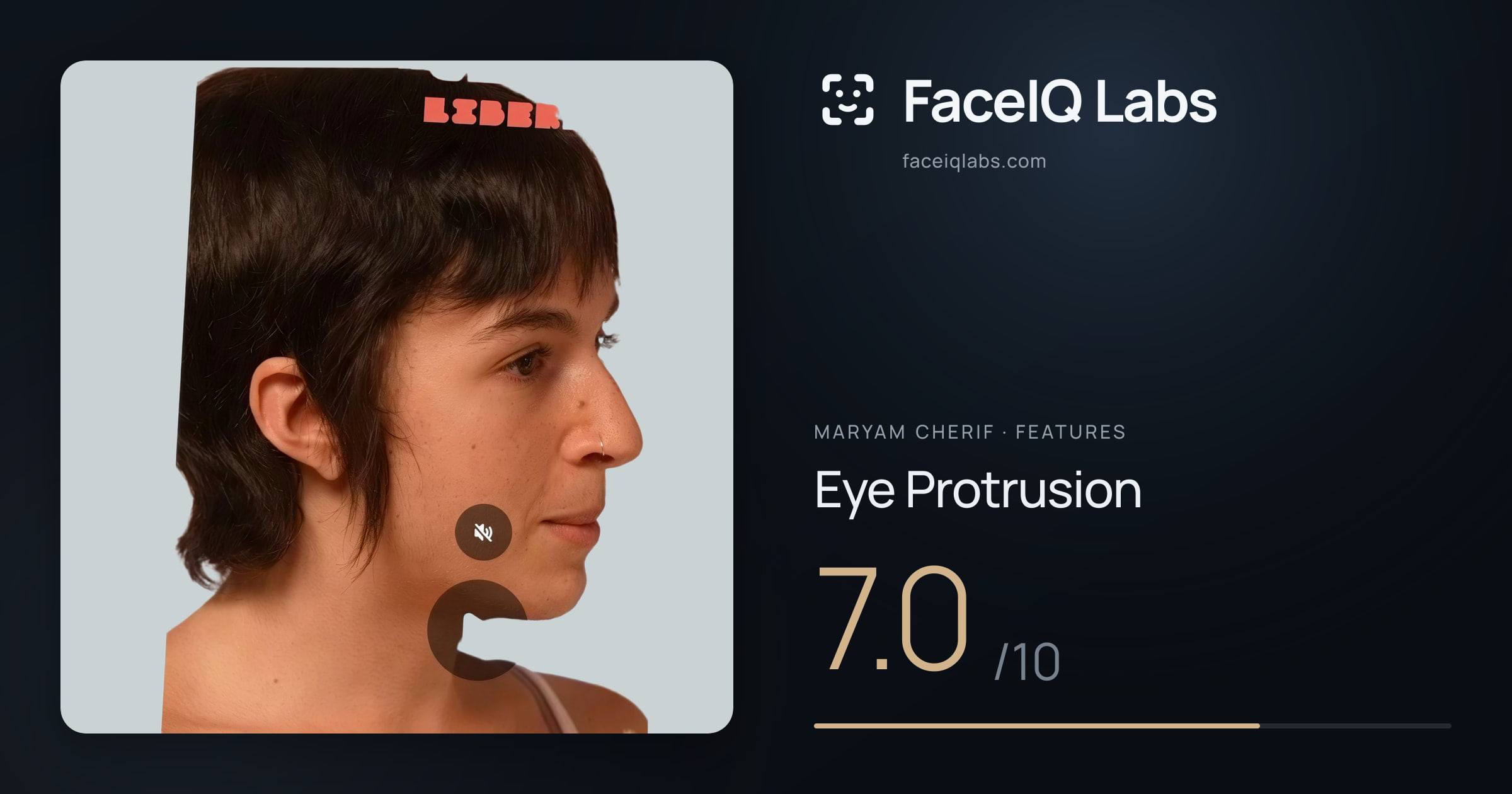 Maryam Cherif Eye Protrusion: 7.0/10, drawn on the photo