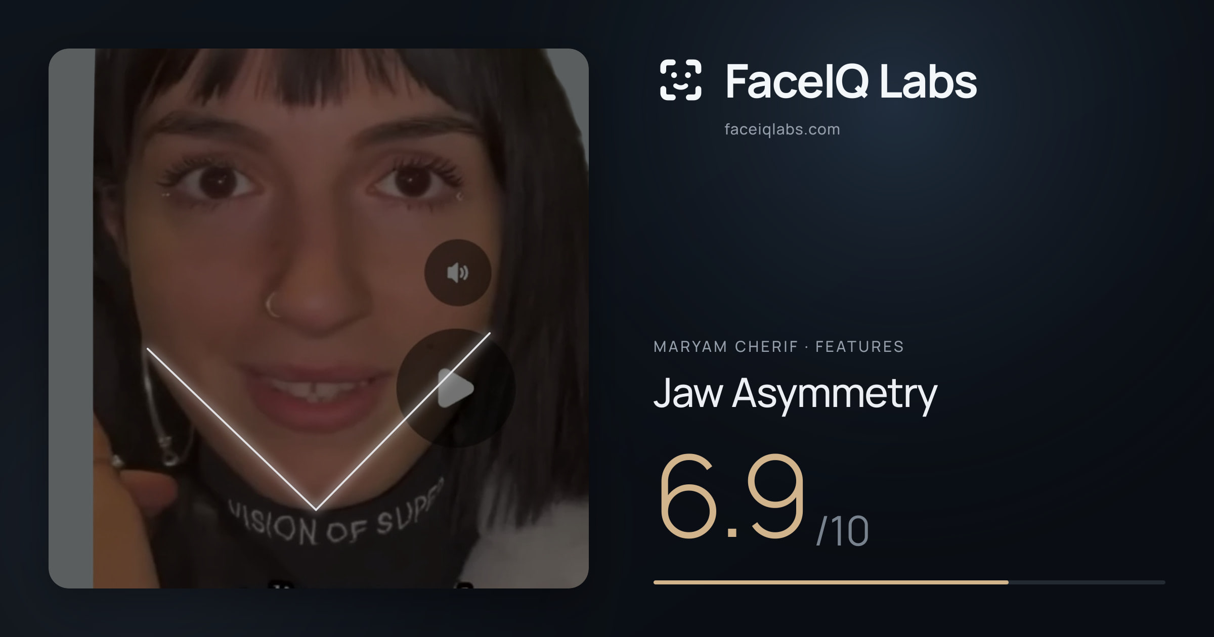Maryam Cherif Jaw Asymmetry: 6.9/10, drawn on the photo