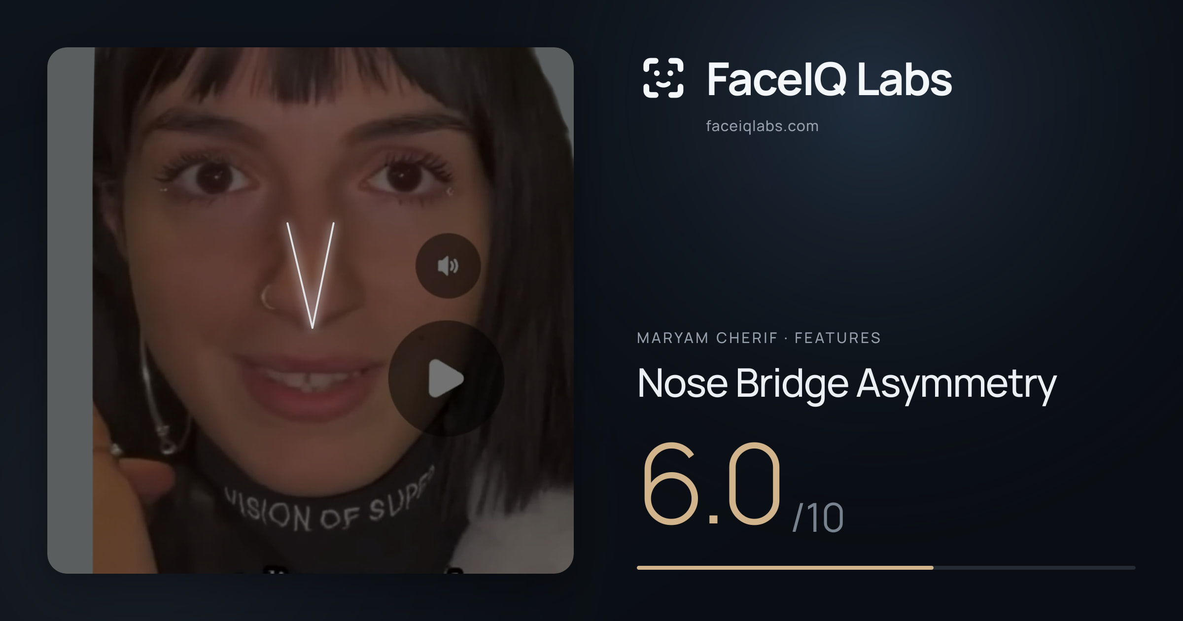 Maryam Cherif Nose Bridge Asymmetry: 6.0/10, drawn on the photo