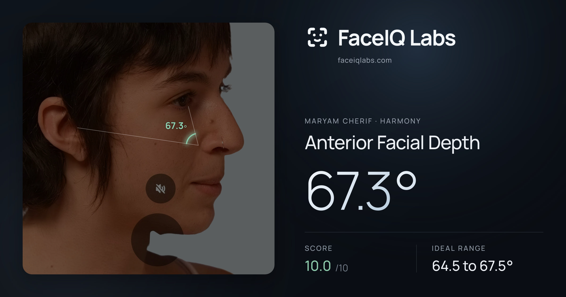 Maryam Cherif Anterior Facial Depth: 67.3°, drawn on the photo