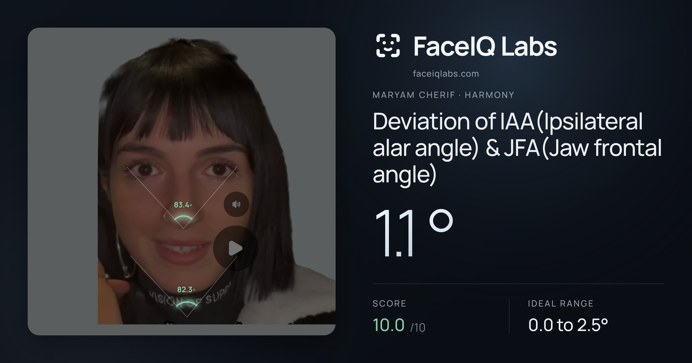 Maryam Cherif Deviation of IAA(Ipsilateral alar angle) & JFA(Jaw frontal angle): 1.1°, drawn on the photo