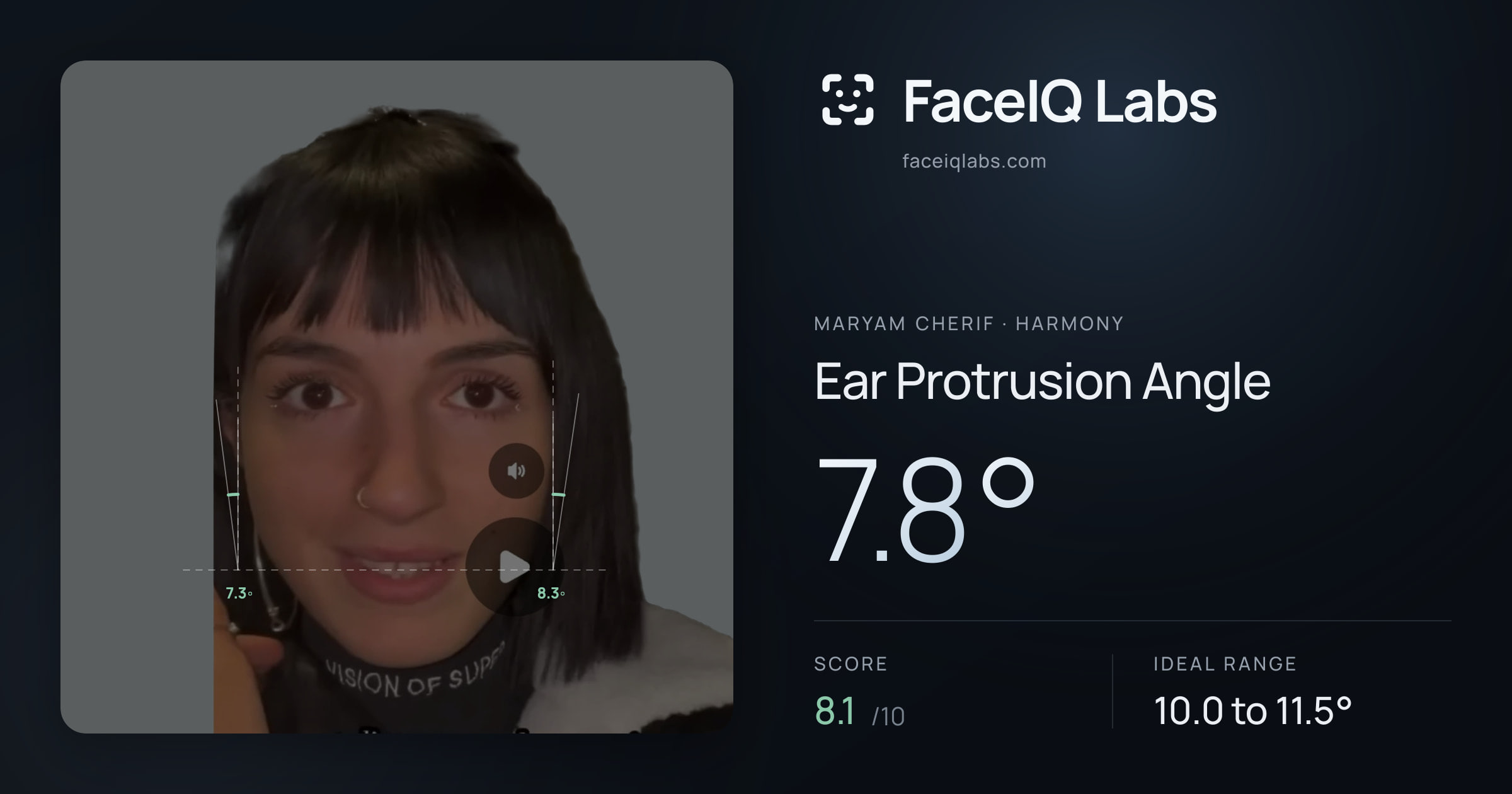 Maryam Cherif Ear Protrusion Angle: 7.8°, drawn on the photo