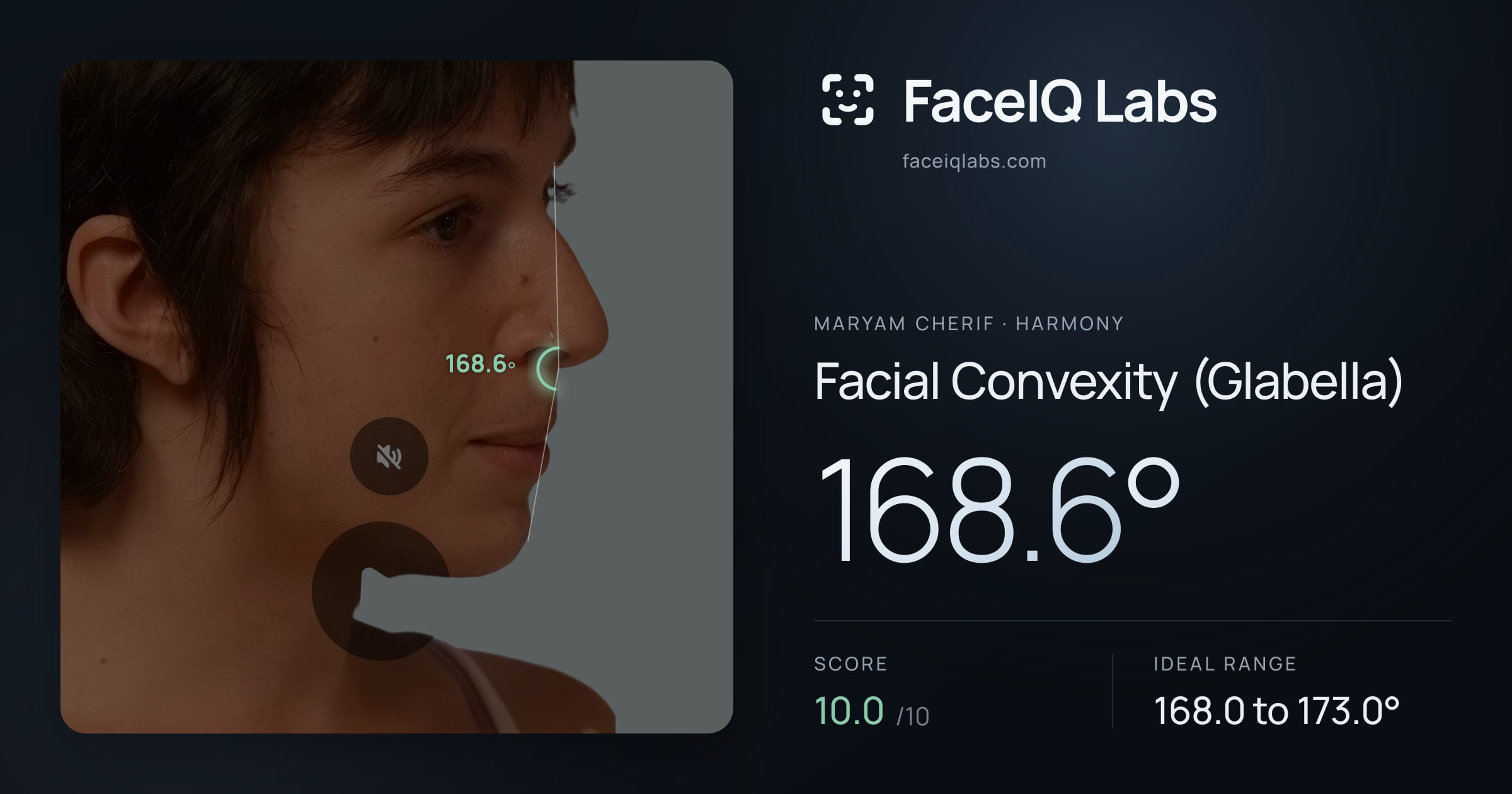Maryam Cherif Facial Convexity (Glabella): 168.6°, drawn on the photo