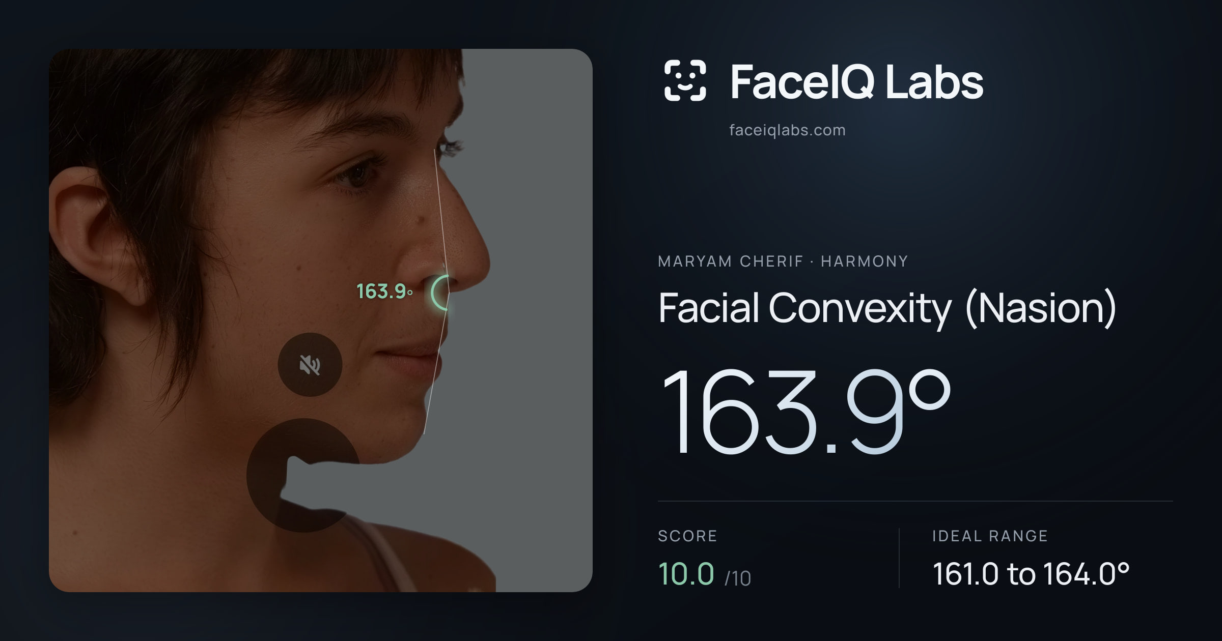 Maryam Cherif Facial Convexity (Nasion): 163.9°, drawn on the photo