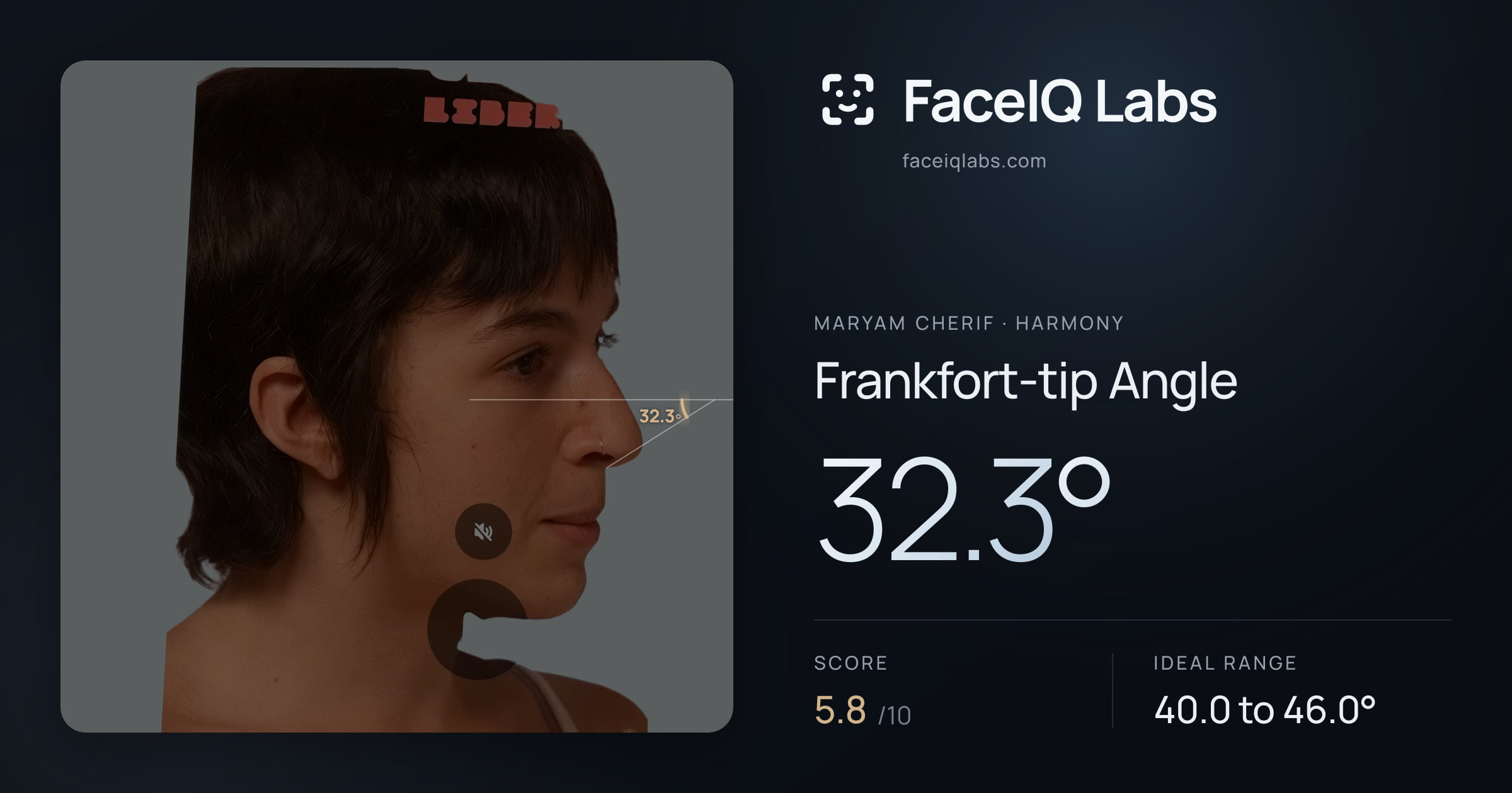 Maryam Cherif Frankfort-tip Angle: 32.3°, drawn on the photo