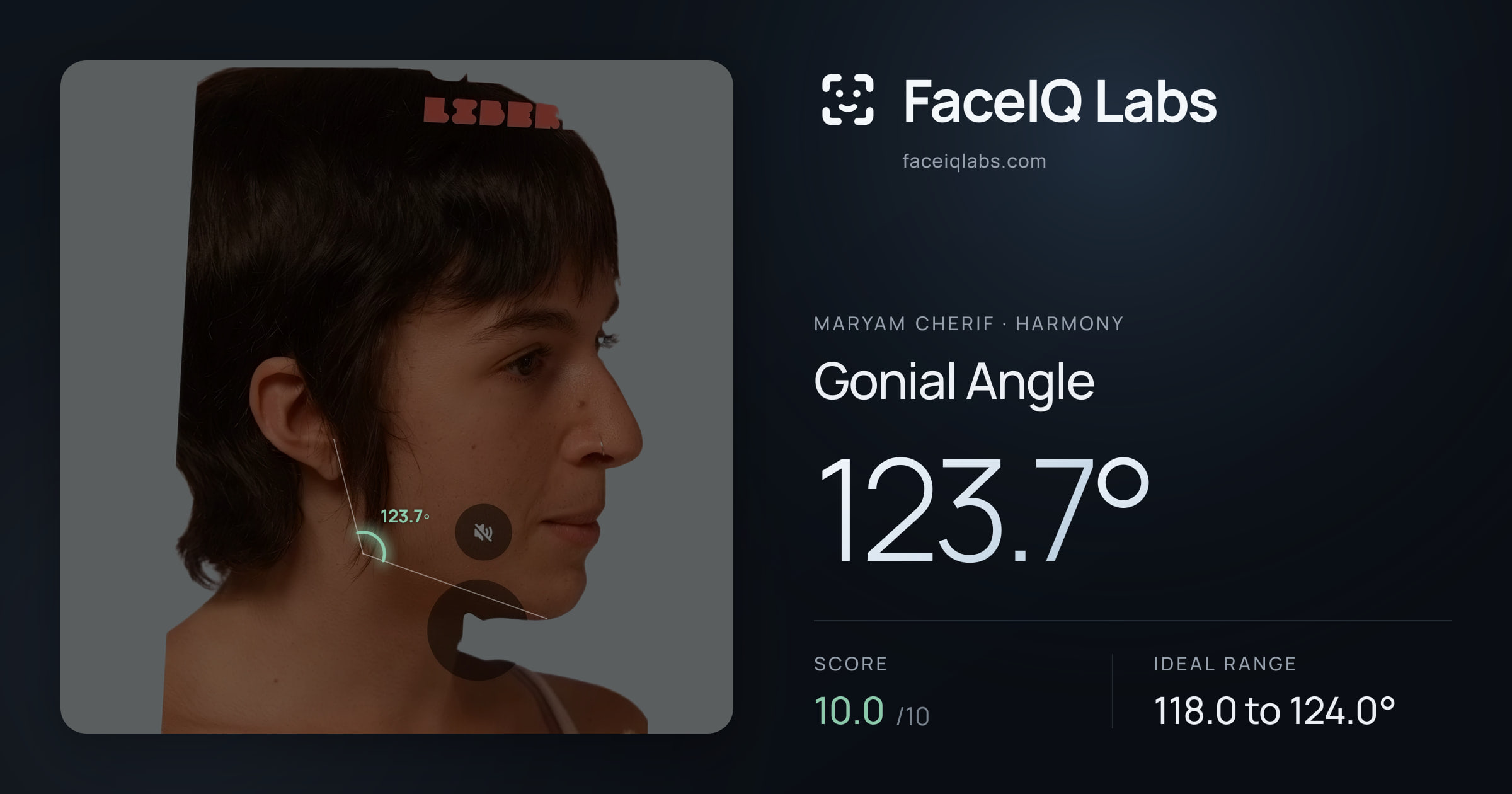 Maryam Cherif Gonial Angle: 123.7°, drawn on the photo