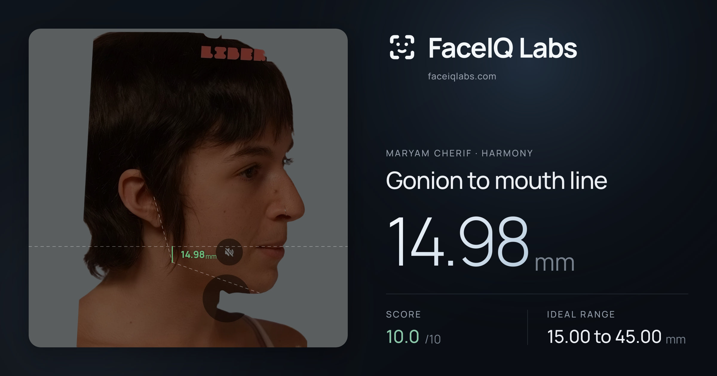 Maryam Cherif Gonion to mouth line: 14.98mm, drawn on the photo