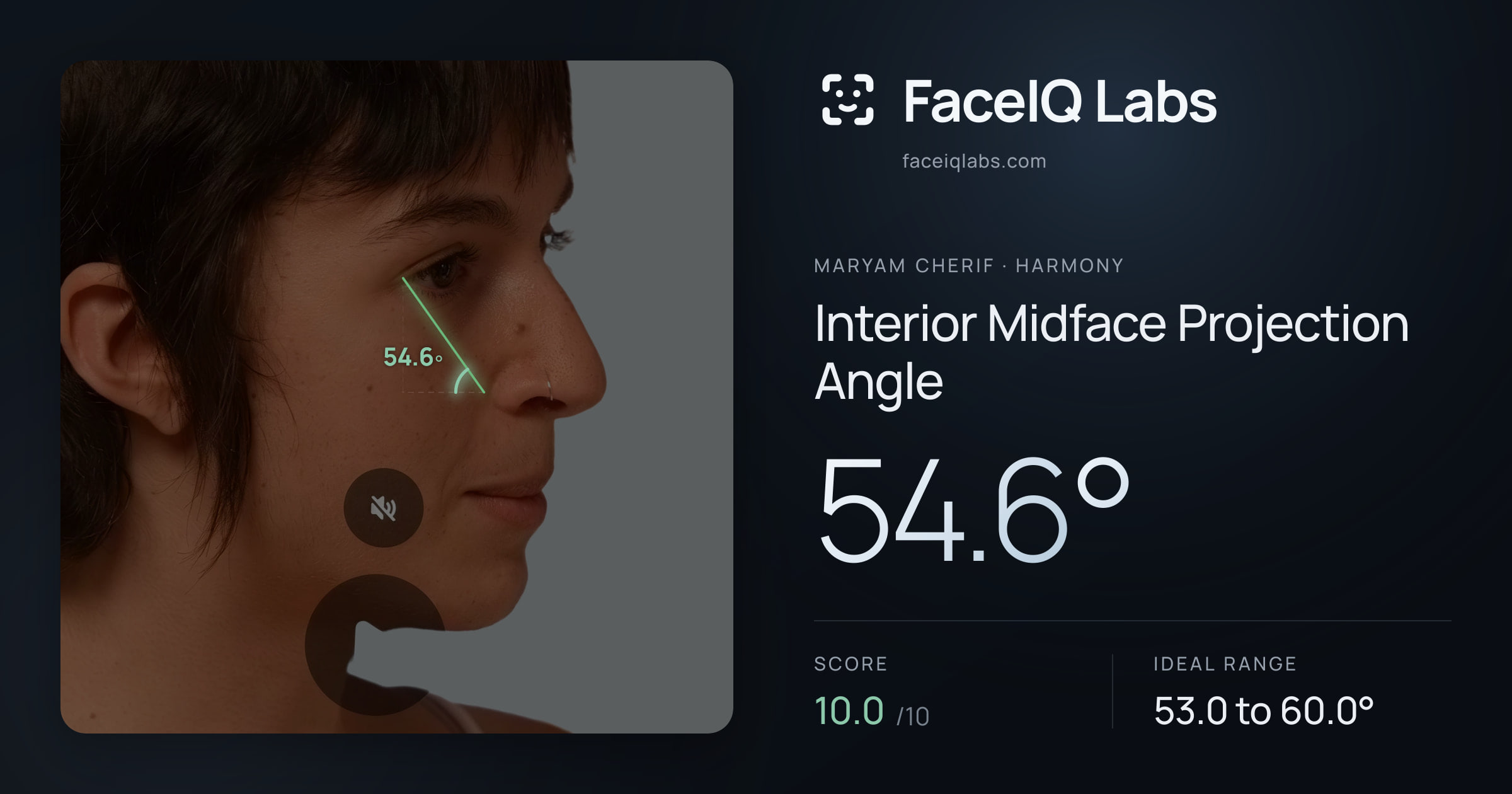 Maryam Cherif Interior Midface Projection Angle: 54.6°, drawn on the photo