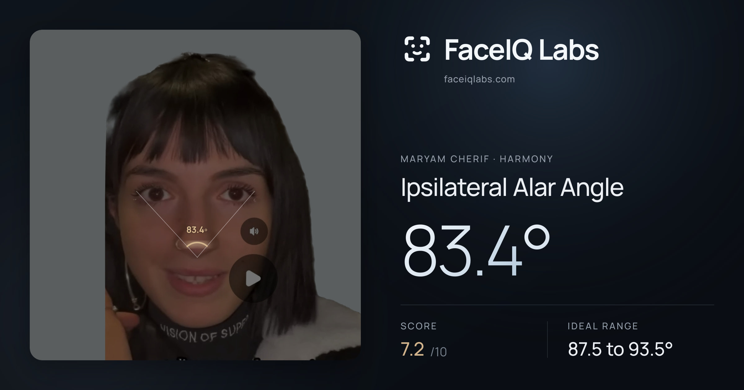Maryam Cherif Ipsilateral Alar Angle: 83.4°, drawn on the photo