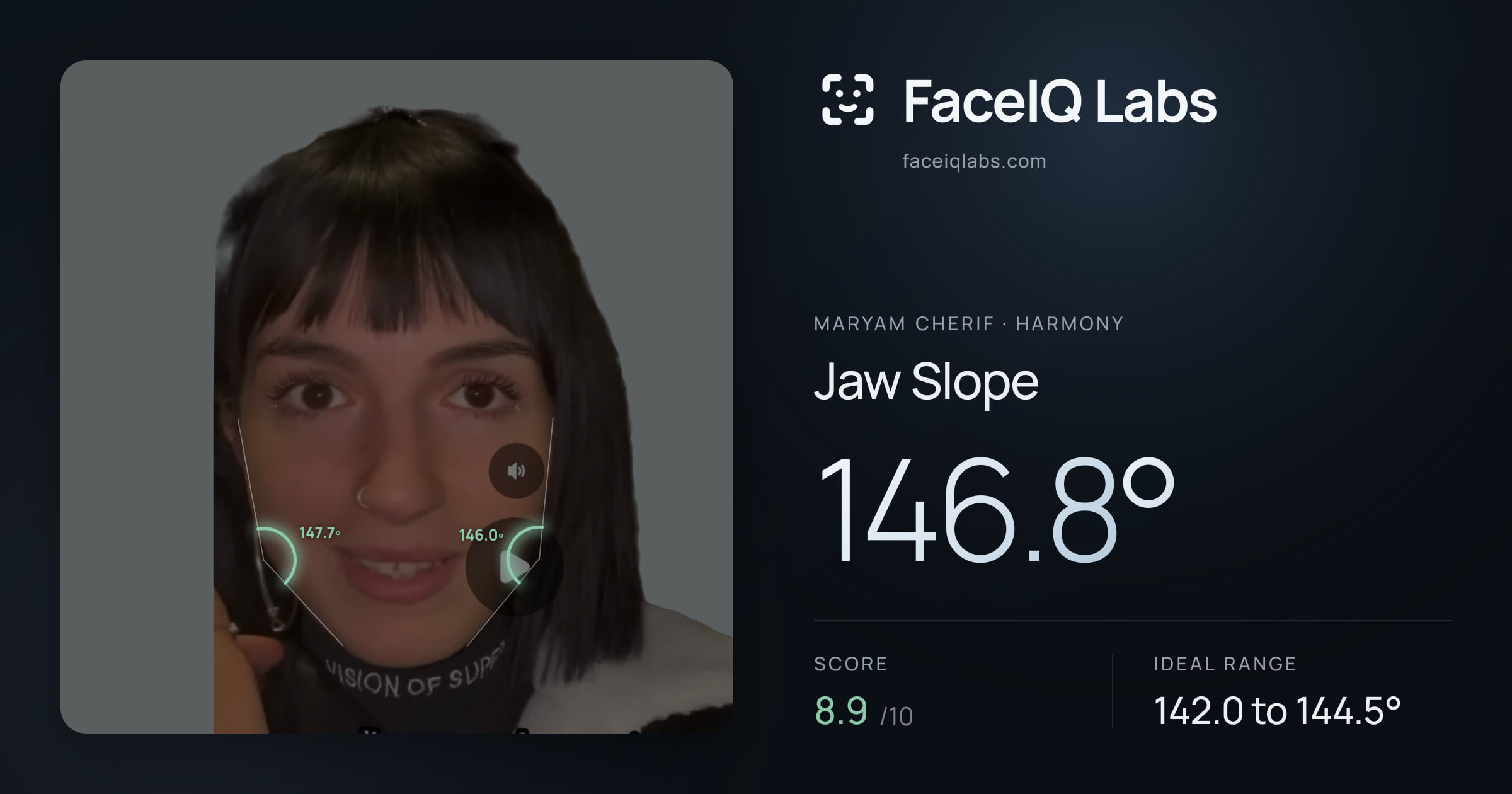 Maryam Cherif Jaw Slope: 146.8°, drawn on the photo