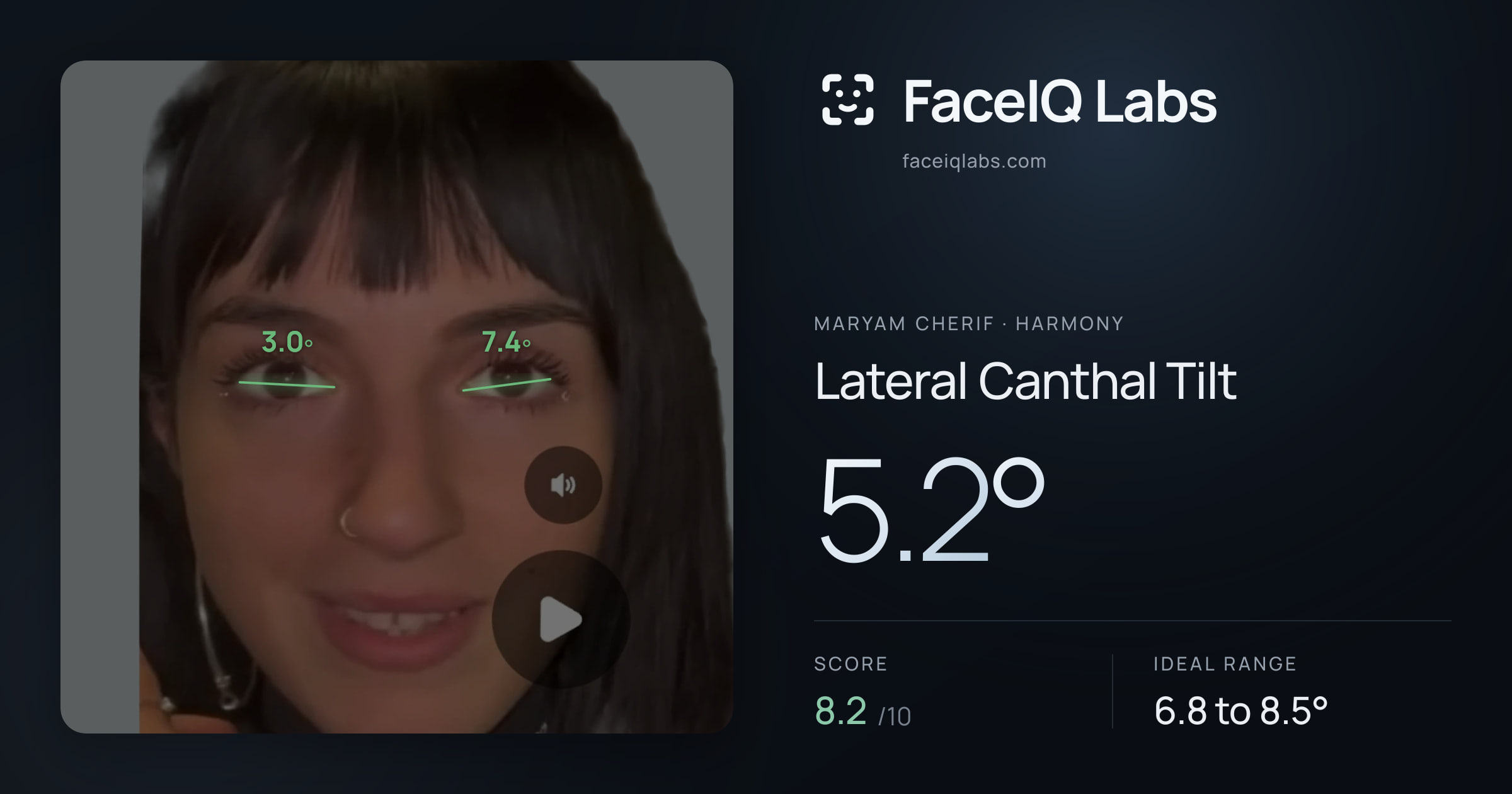 Maryam Cherif Lateral Canthal Tilt: 5.2°, drawn on the photo