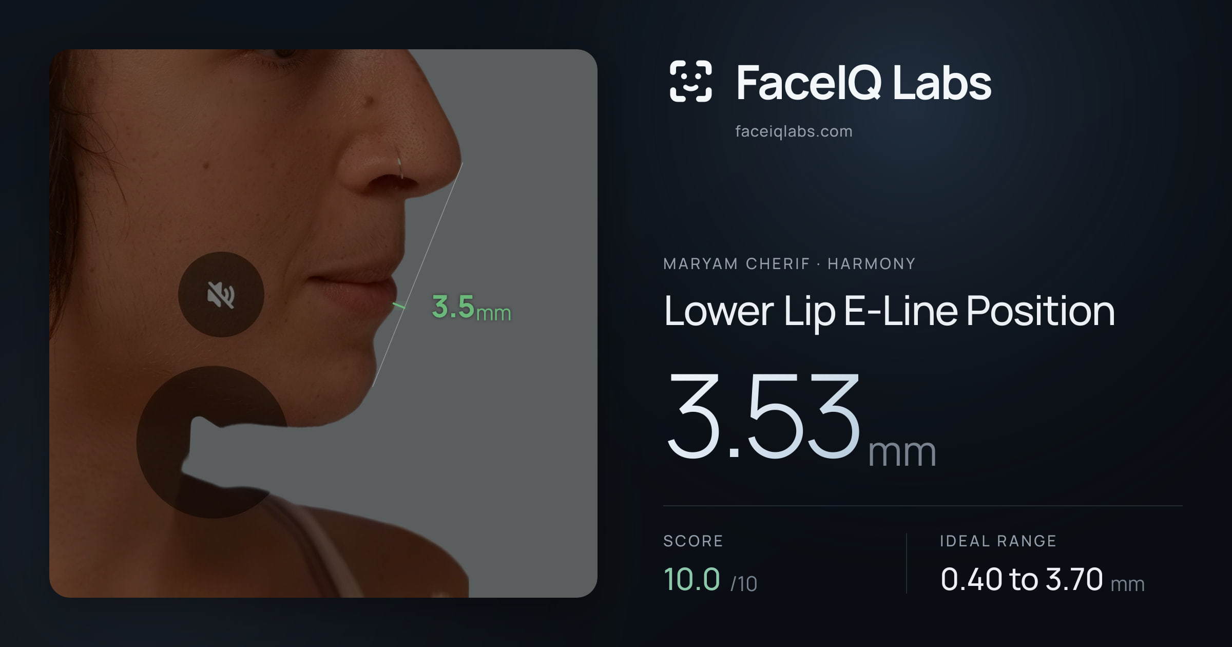 Maryam Cherif Lower Lip E-Line Position: 3.53mm, drawn on the photo