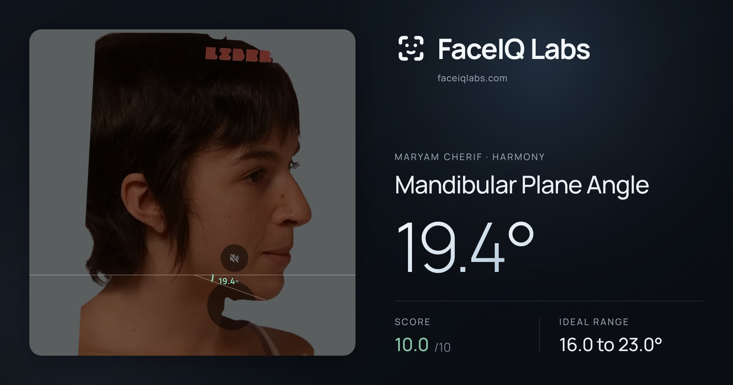 Maryam Cherif Mandibular Plane Angle: 19.4°, drawn on the photo