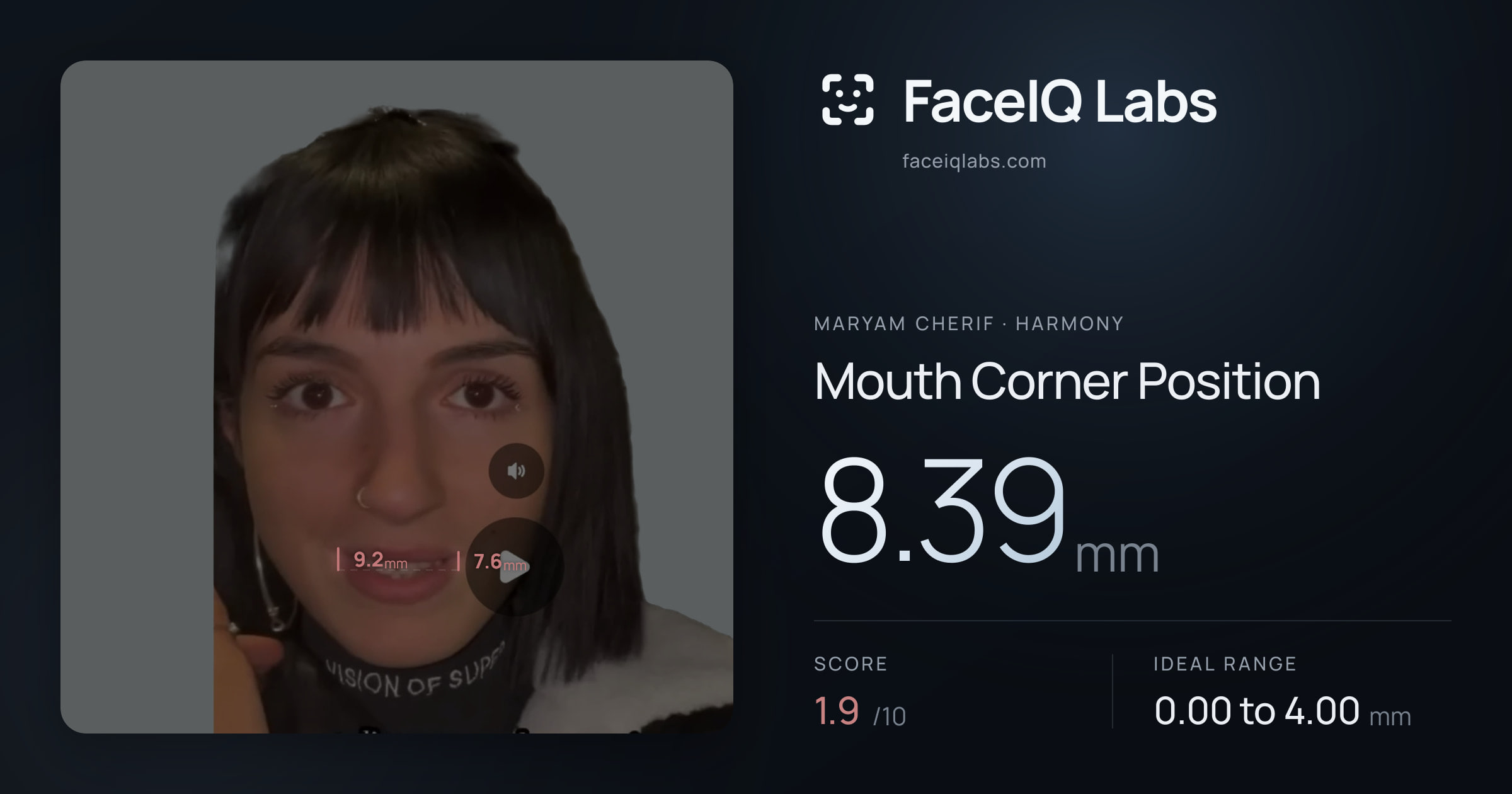Maryam Cherif Mouth Corner Position: 8.39mm, drawn on the photo