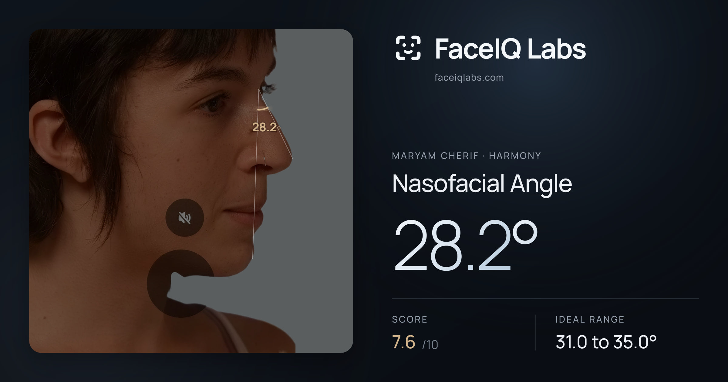 Maryam Cherif Nasofacial Angle: 28.2°, drawn on the photo