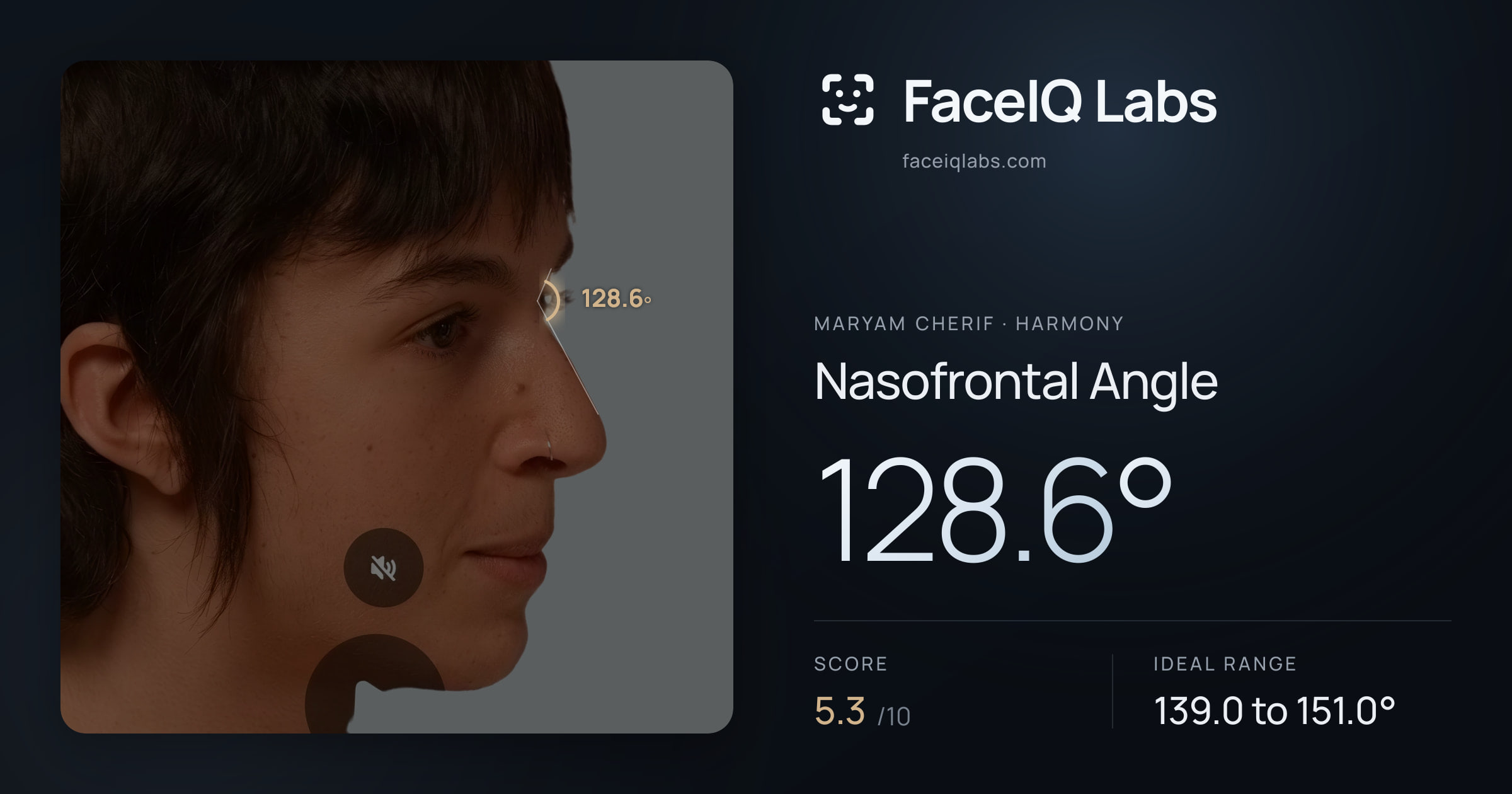 Maryam Cherif Nasofrontal Angle: 128.6°, drawn on the photo