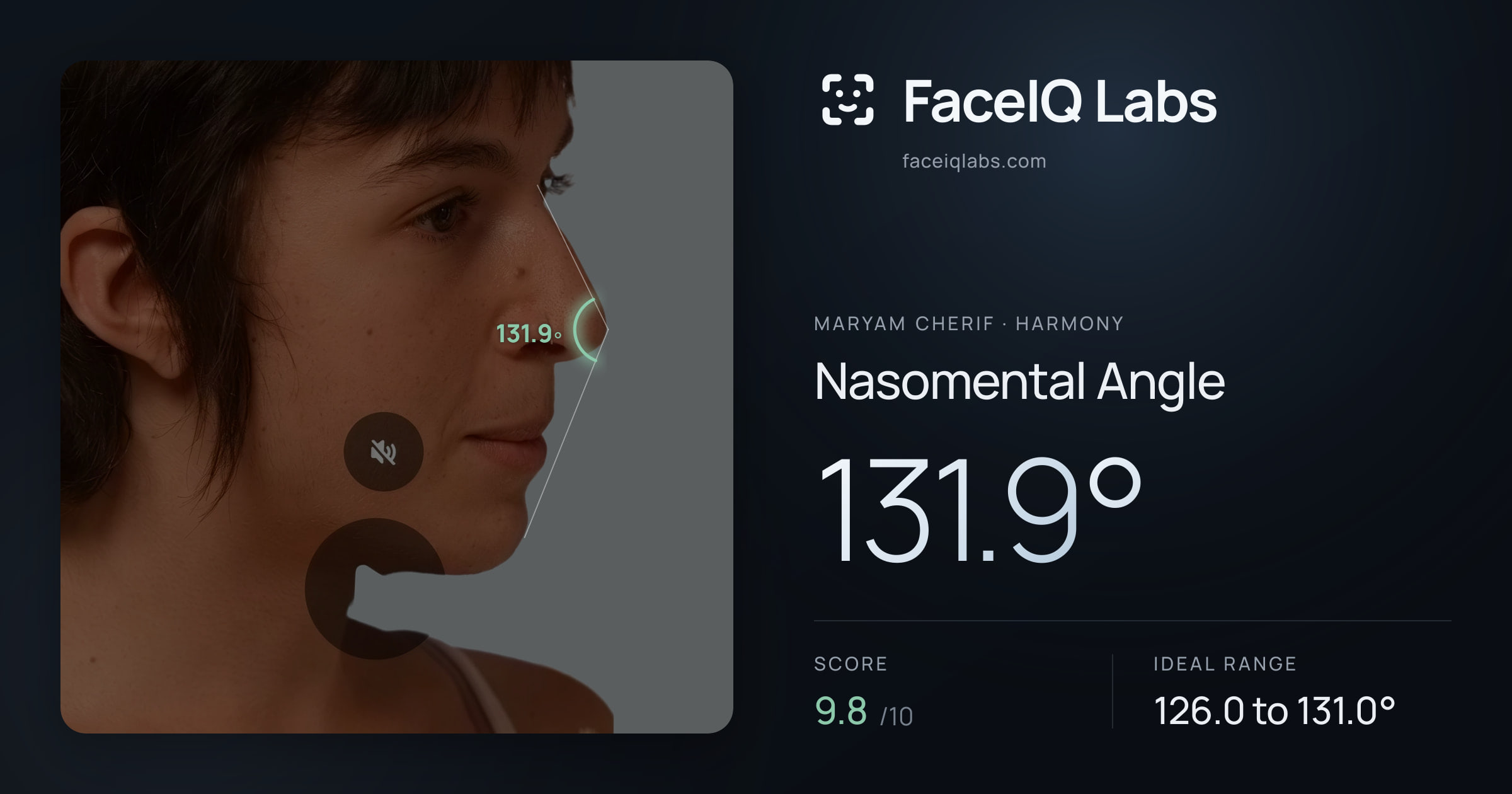 Maryam Cherif Nasomental Angle: 131.9°, drawn on the photo