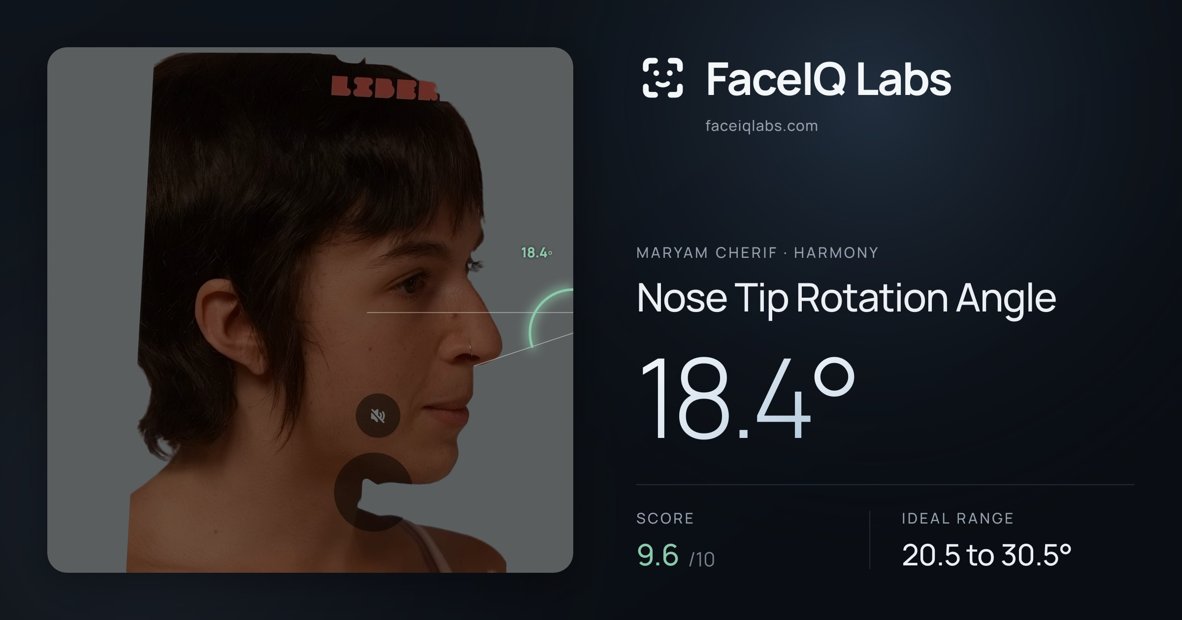 Maryam Cherif Nose Tip Rotation Angle: 18.4°, drawn on the photo