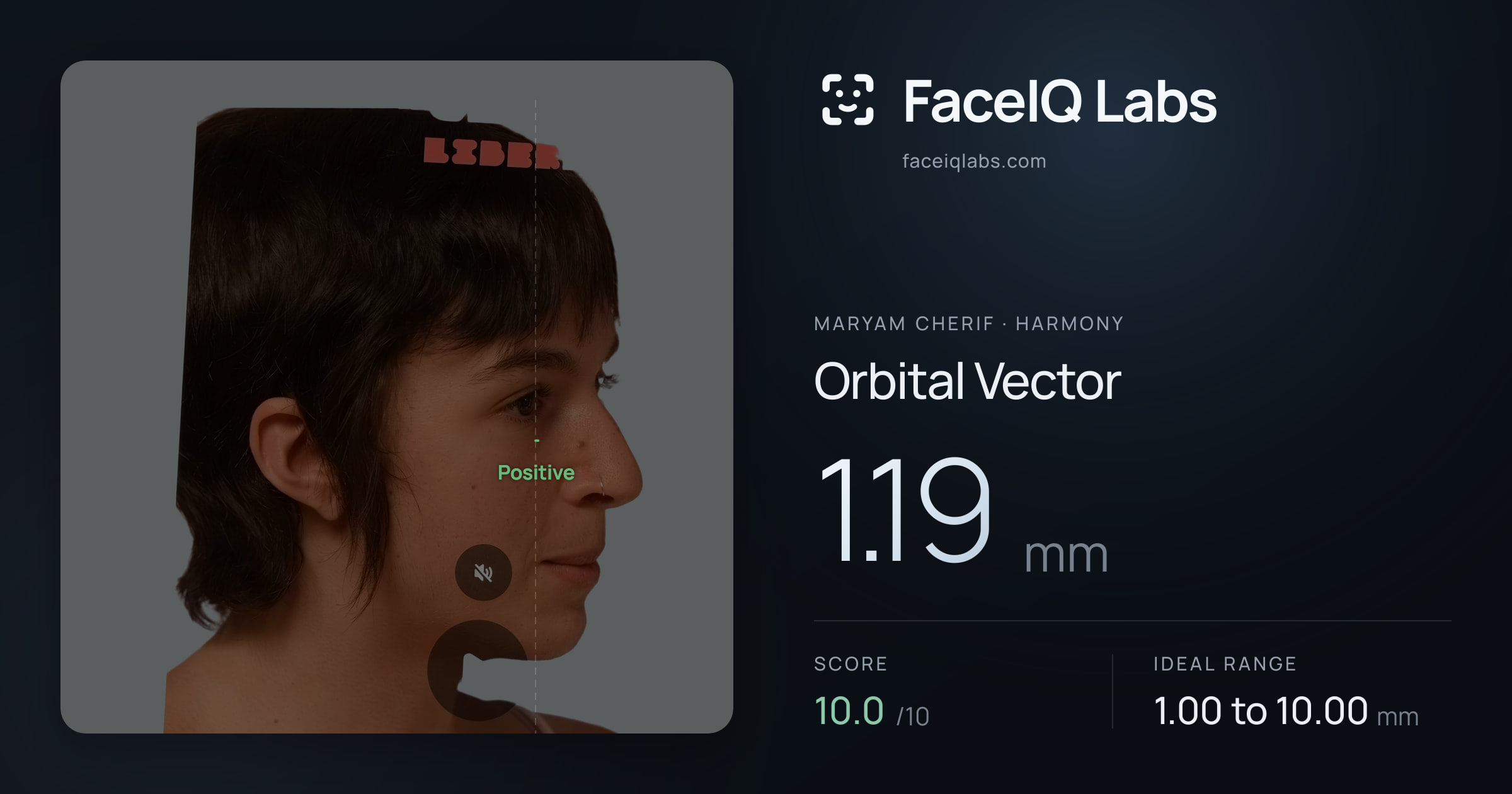 Maryam Cherif Orbital Vector: 1.19mm, drawn on the photo