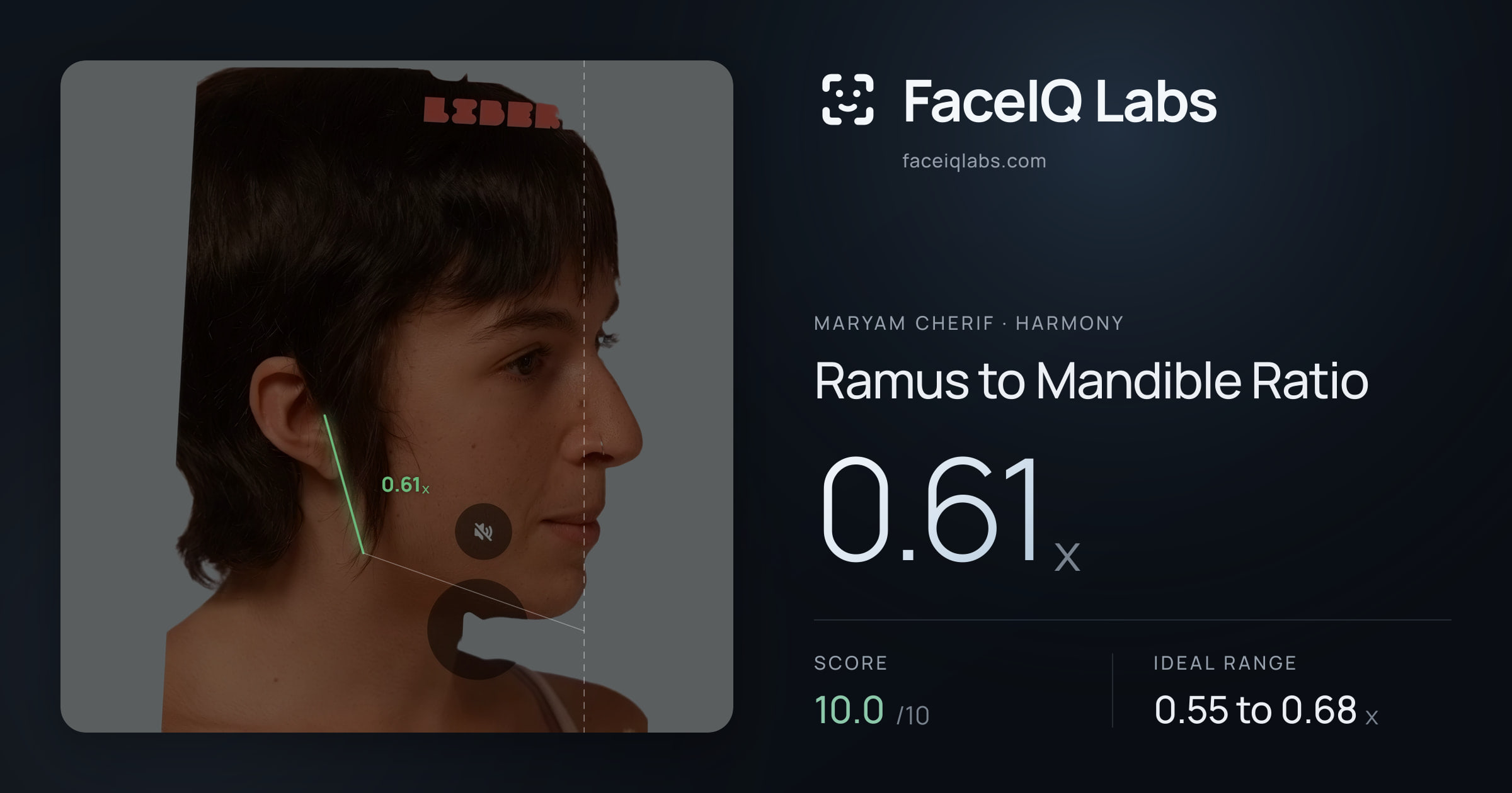 Maryam Cherif Ramus to Mandible Ratio: 0.61x, drawn on the photo