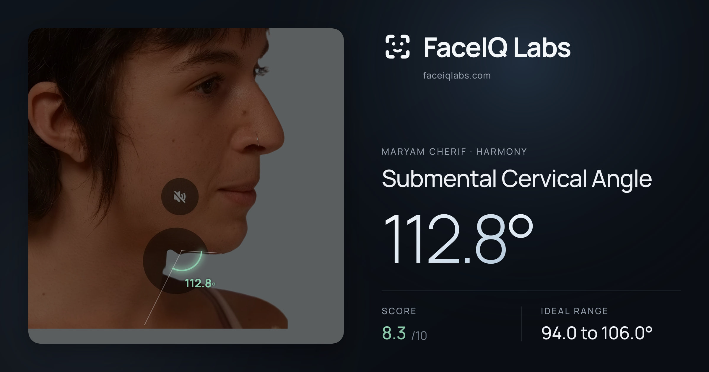 Maryam Cherif Submental Cervical Angle: 112.8°, drawn on the photo