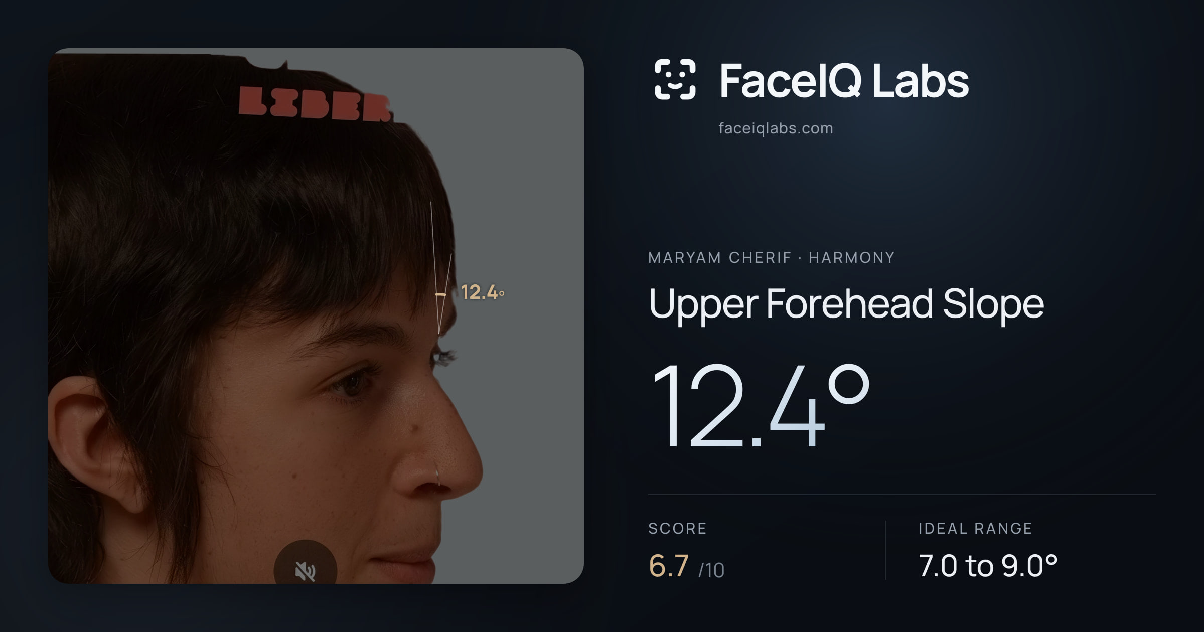 Maryam Cherif Upper Forehead Slope: 12.4°, drawn on the photo